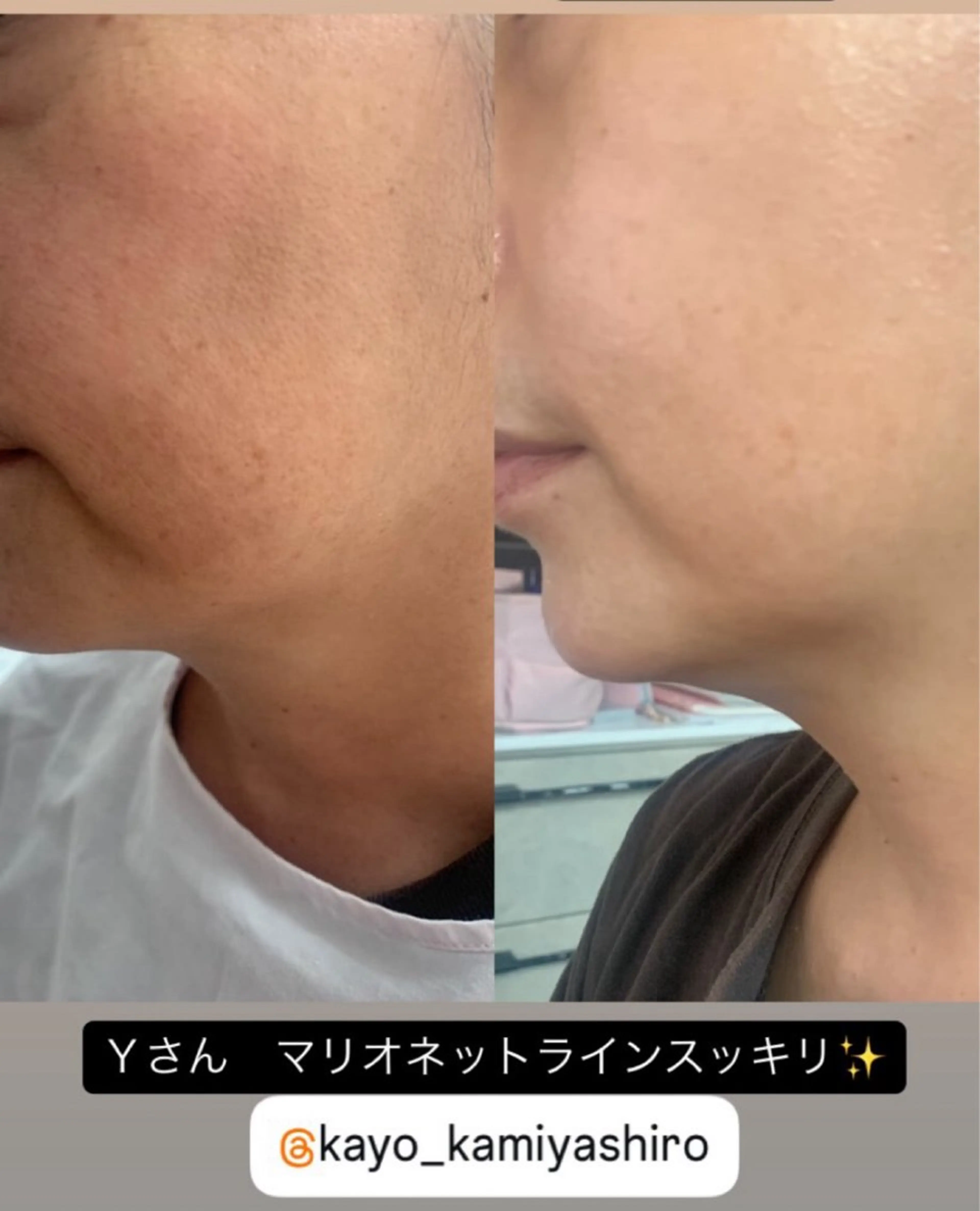 水田 かよのエステ・リラクイメージ