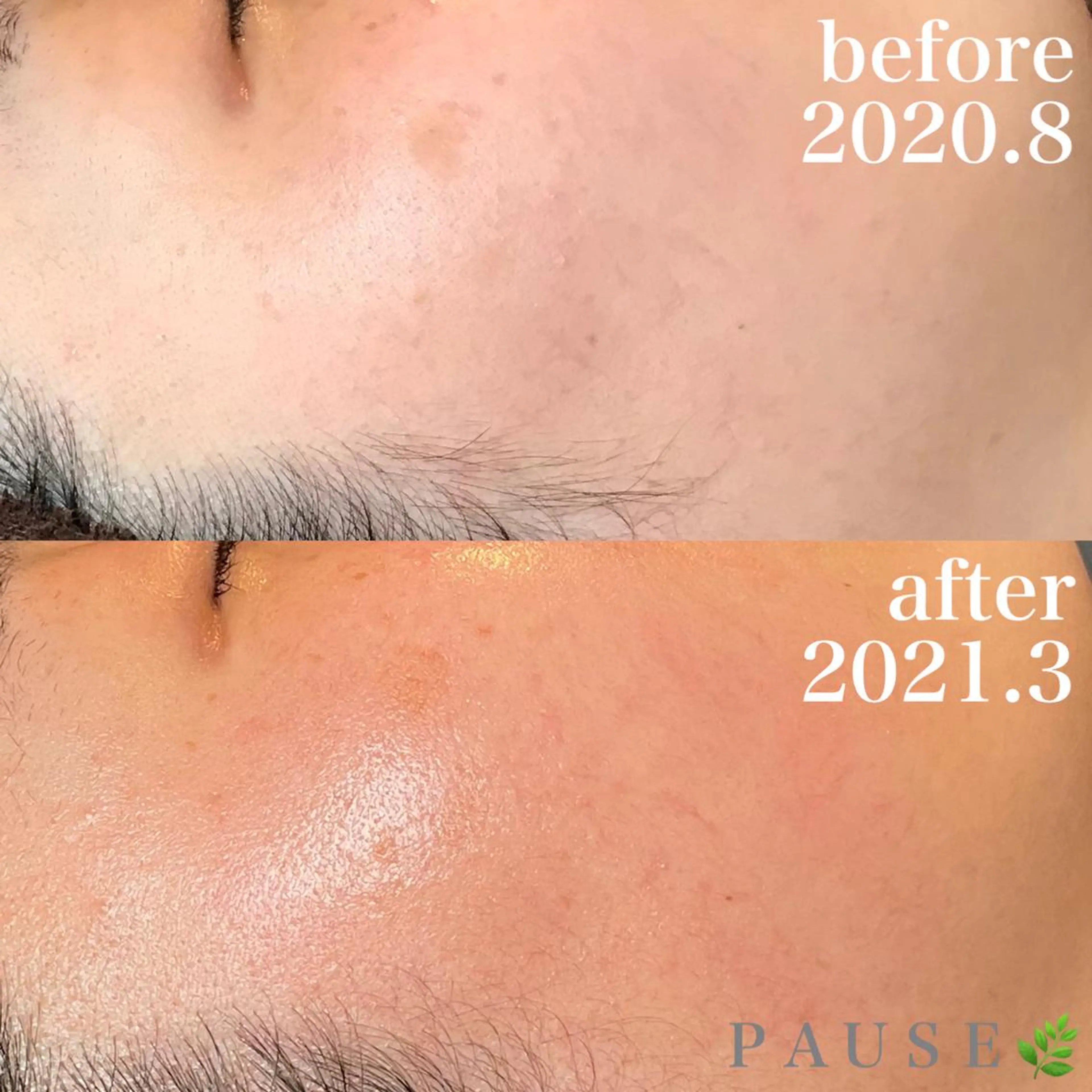 エステ 浜野 恵美のエステ・リラクイメージ