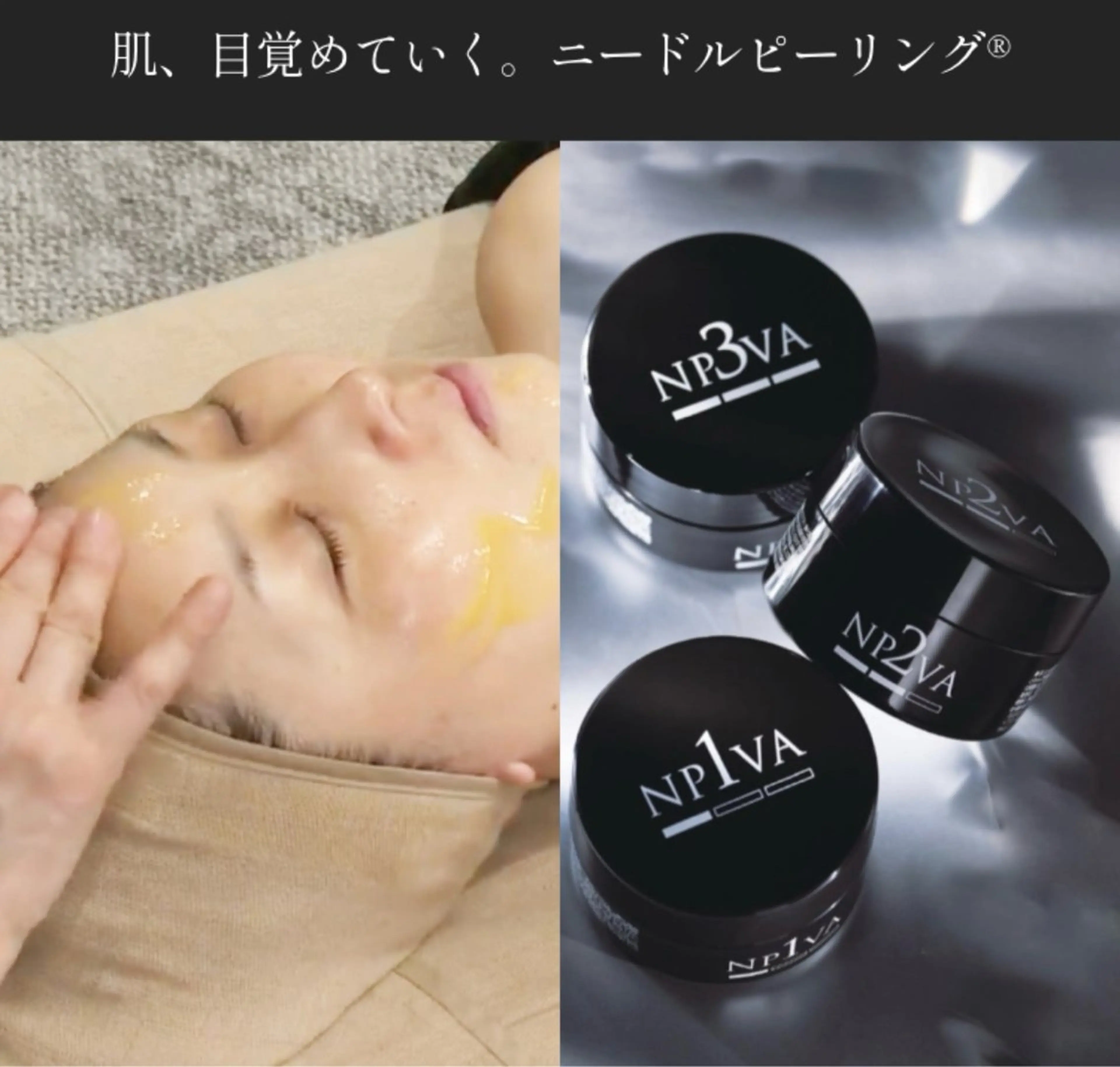 マイクロニードルを1500万本導入！驚異のリフトアップ効果✨シミ・たるみに効果絶大の美肌効果で、肌が生まれ変わる🌷の写真