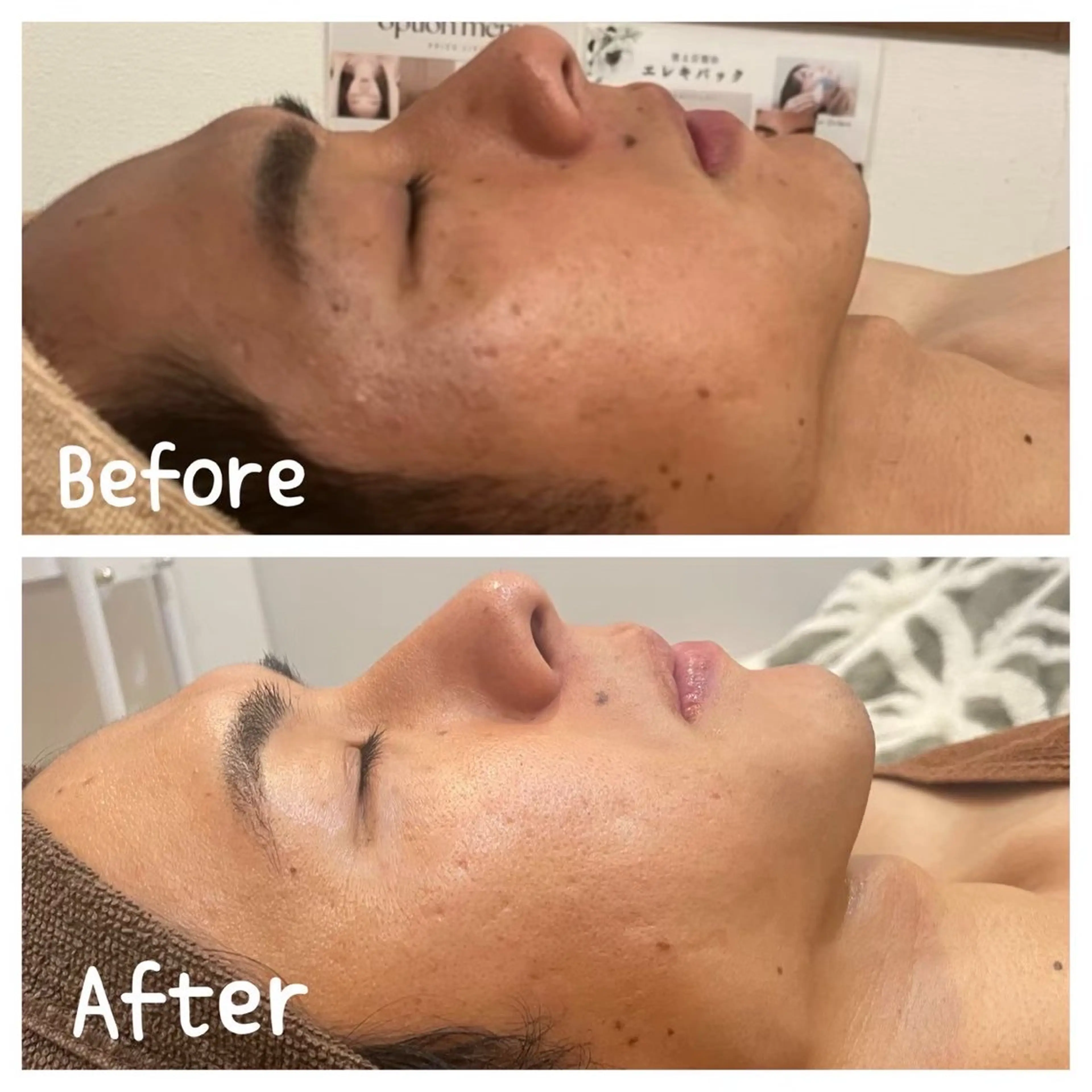 エステ まつげパーマ×眉毛×脱毛　Cerise Lala所属・CeriesLaLa 大船店のエステ・リラクイメージ