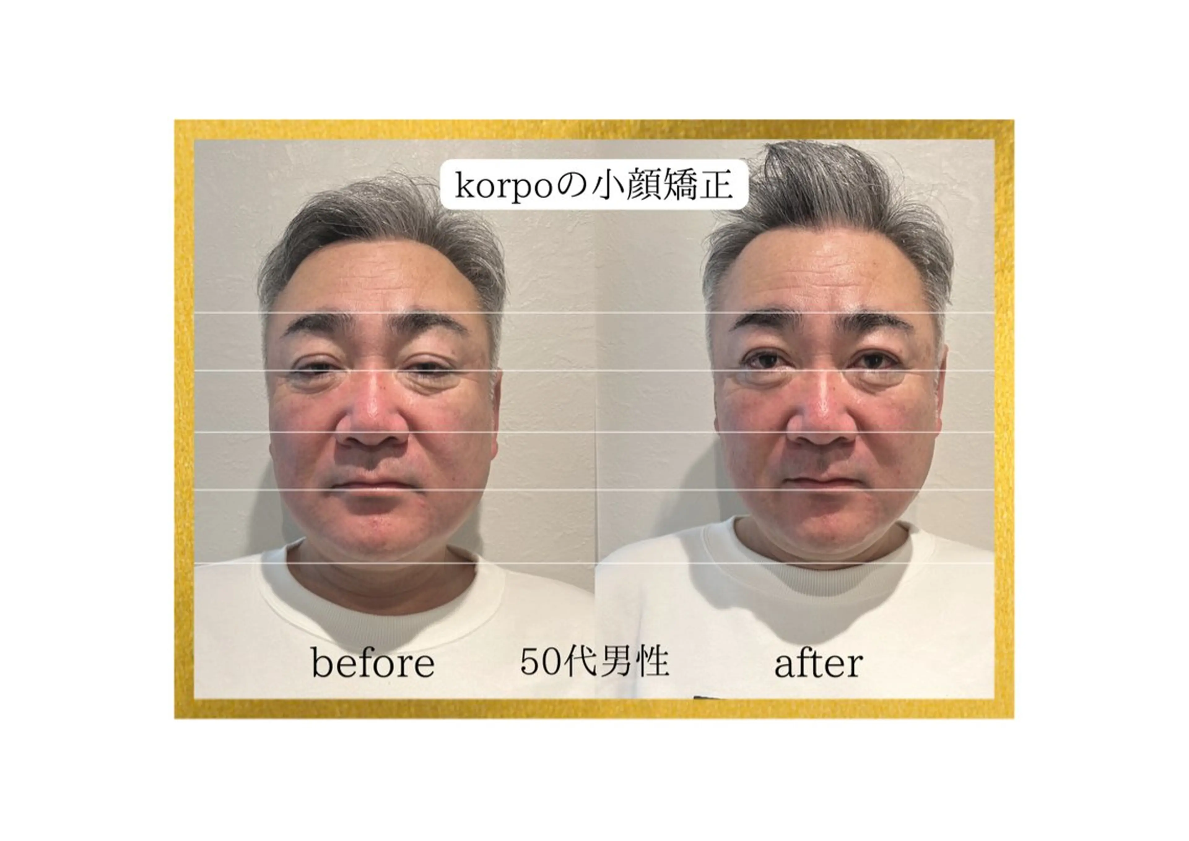 【施術写真モデル】【メンズも大歓迎】🌼小顔矯正🌼フェイス・ドライヘッドスパ（40分）の写真