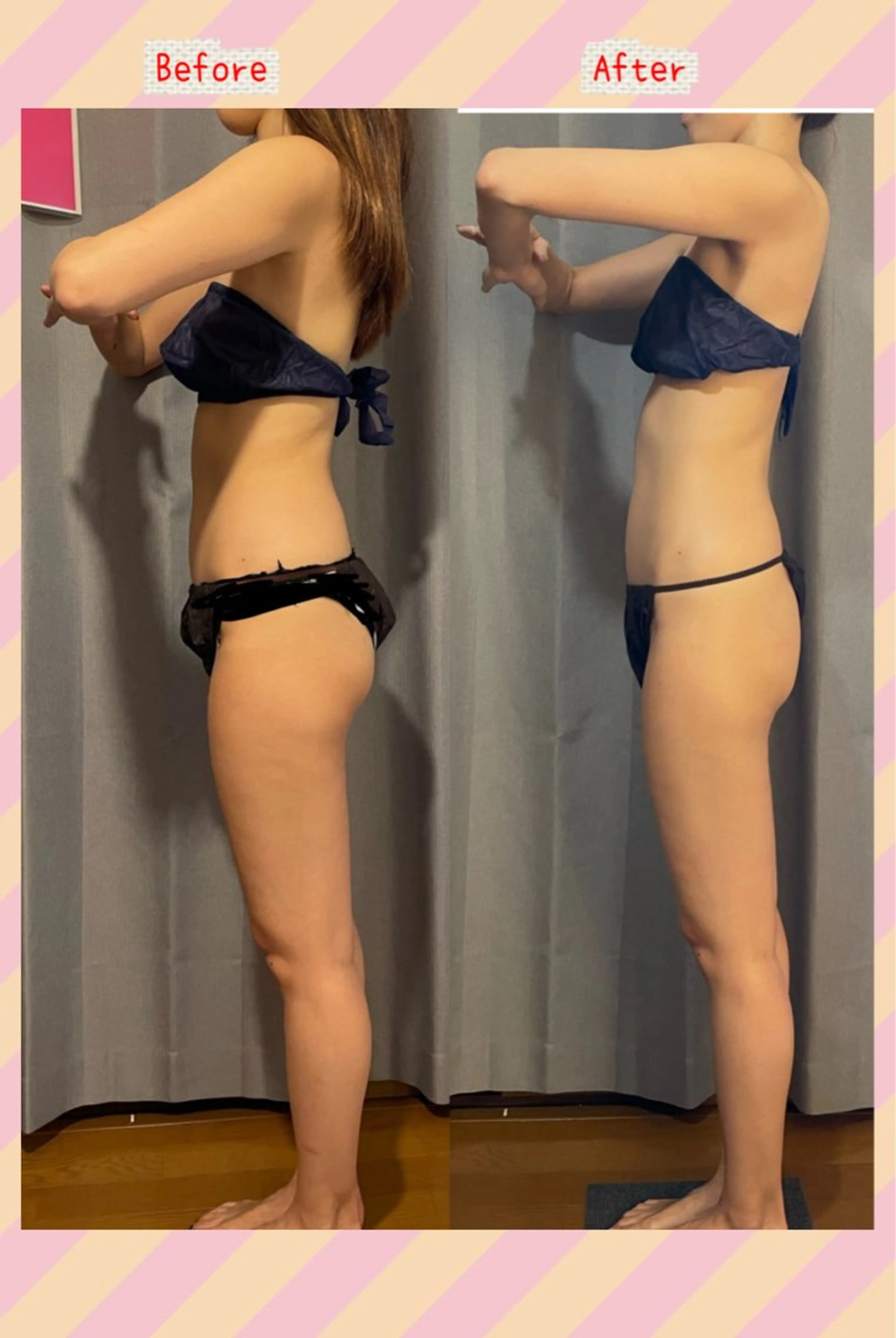 ミディアム カラー パーマ ヘアアレンジ エステ リラク 強圧オールハンド痩身 片野のエステ・リラクイメージ