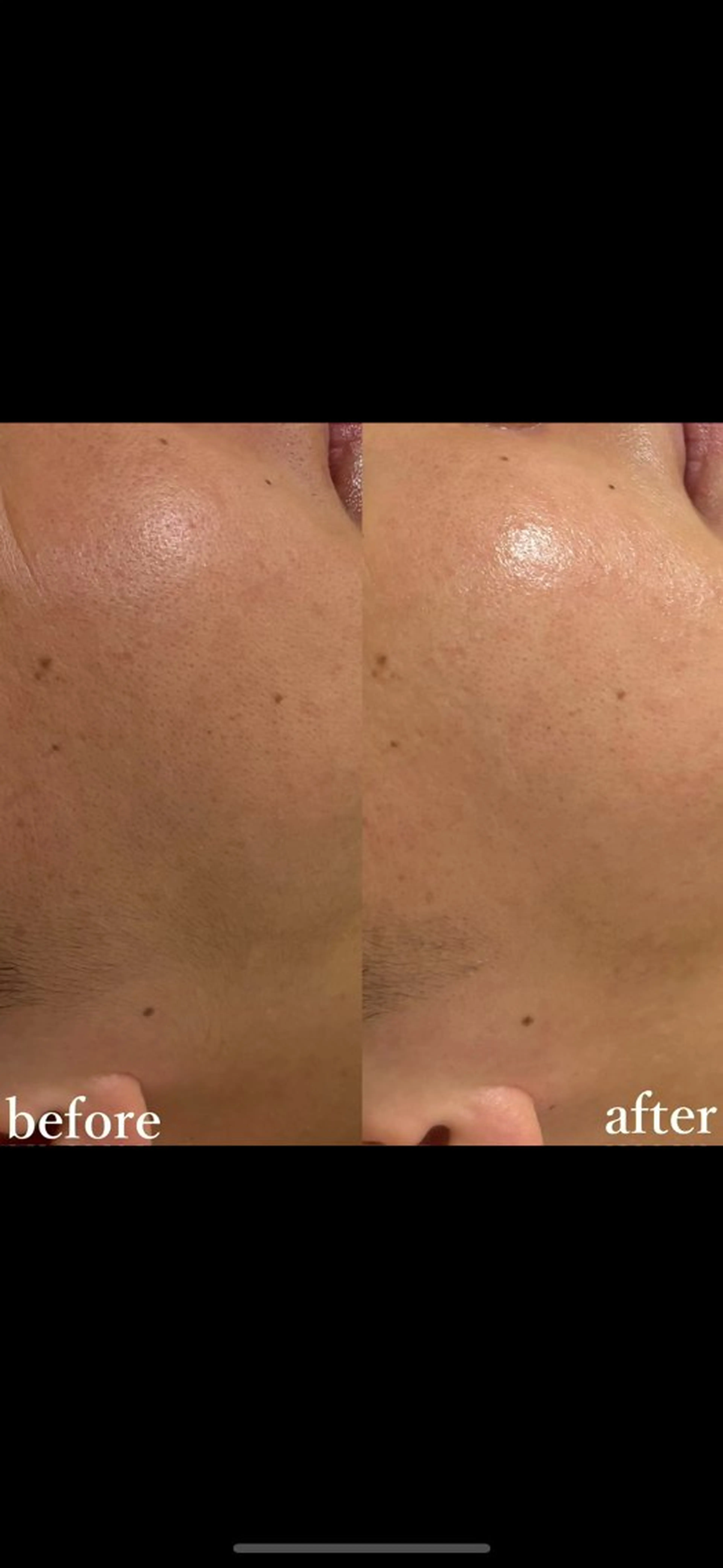 女性専門お顔剃り sunraineのエステ・リラクイメージ