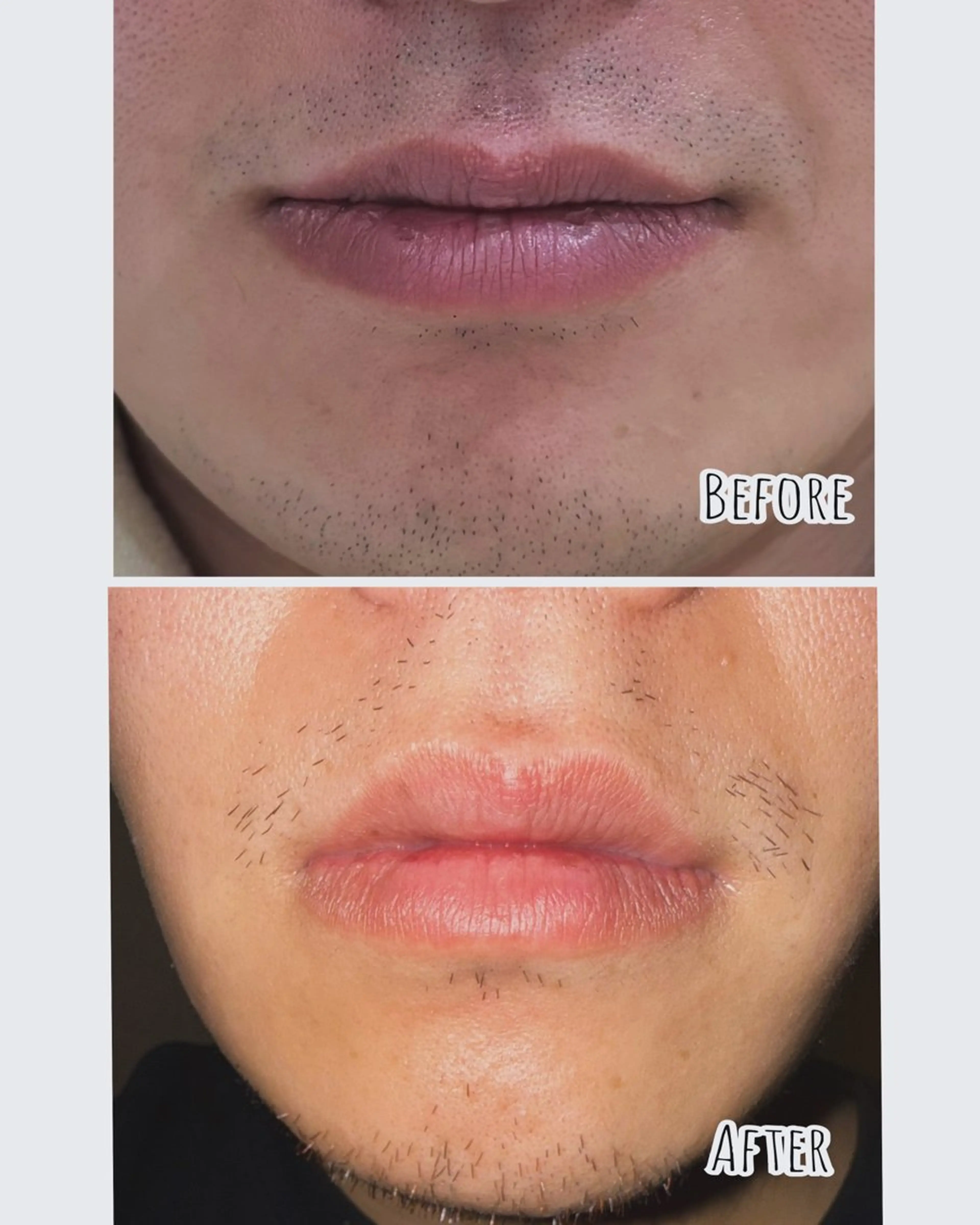 メンズ Tieiu ゆりのエステ・リラクイメージ