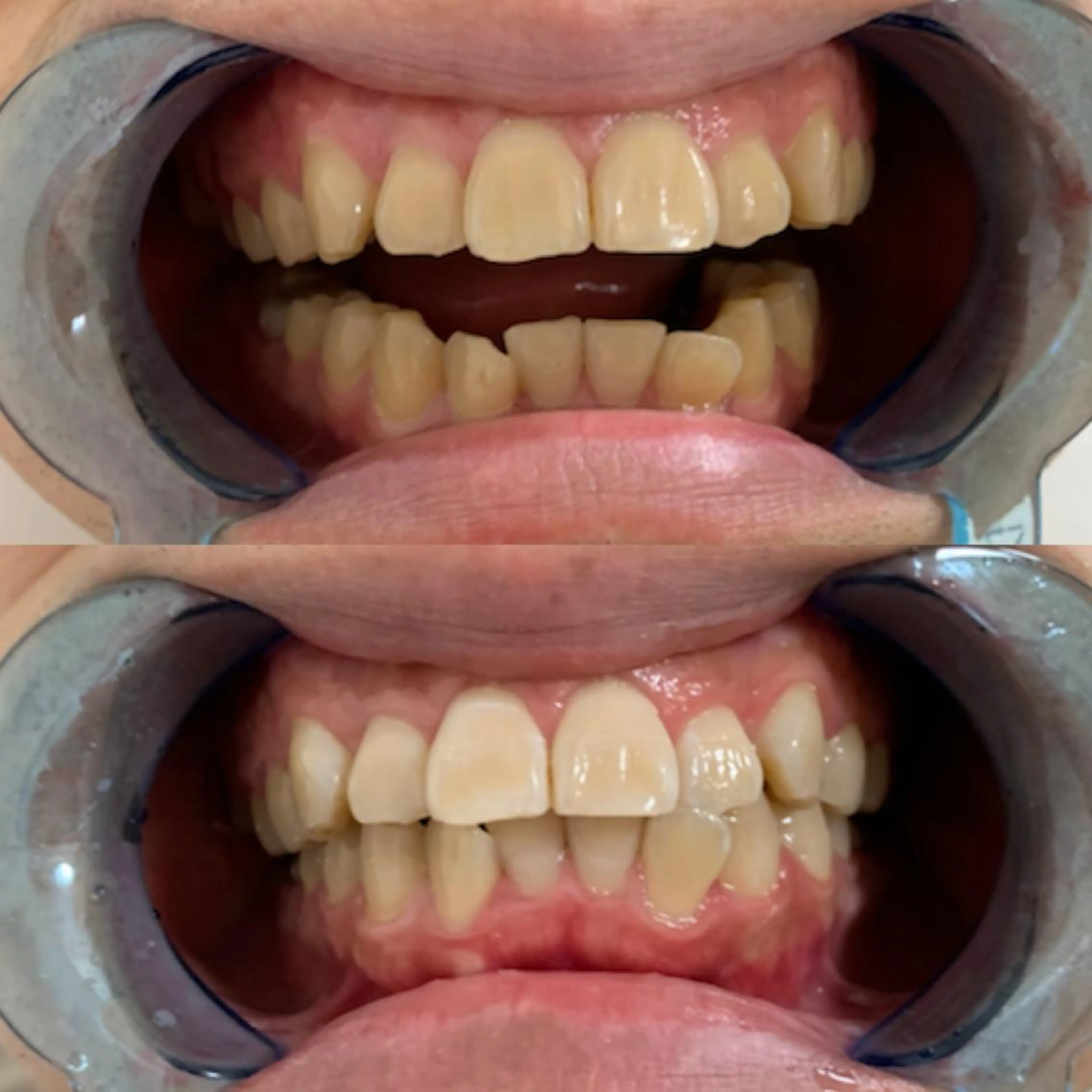 その他 藤本 真心のネイルデザイン