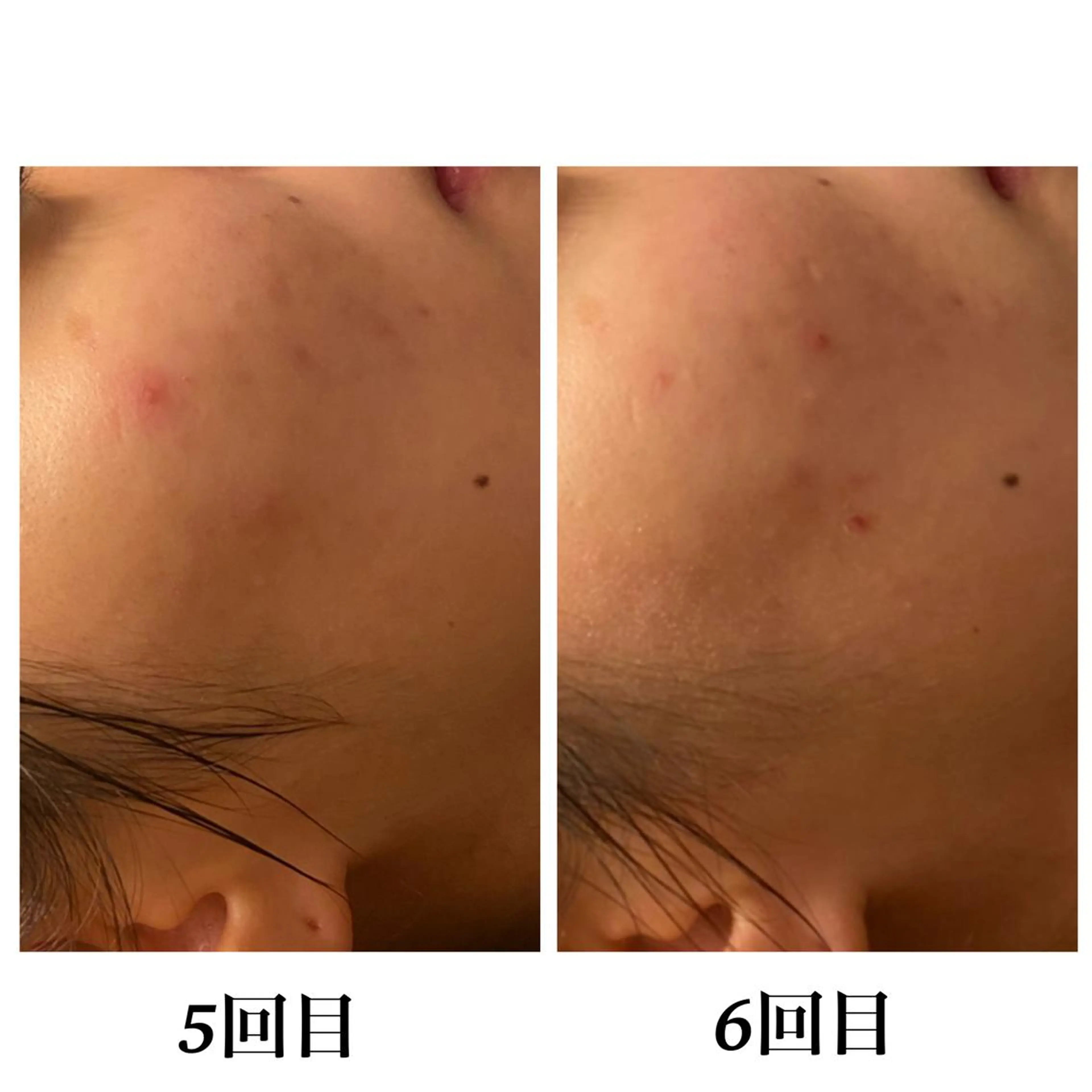 Bellesthe （ベルエステ）のエステ・リラクイメージ