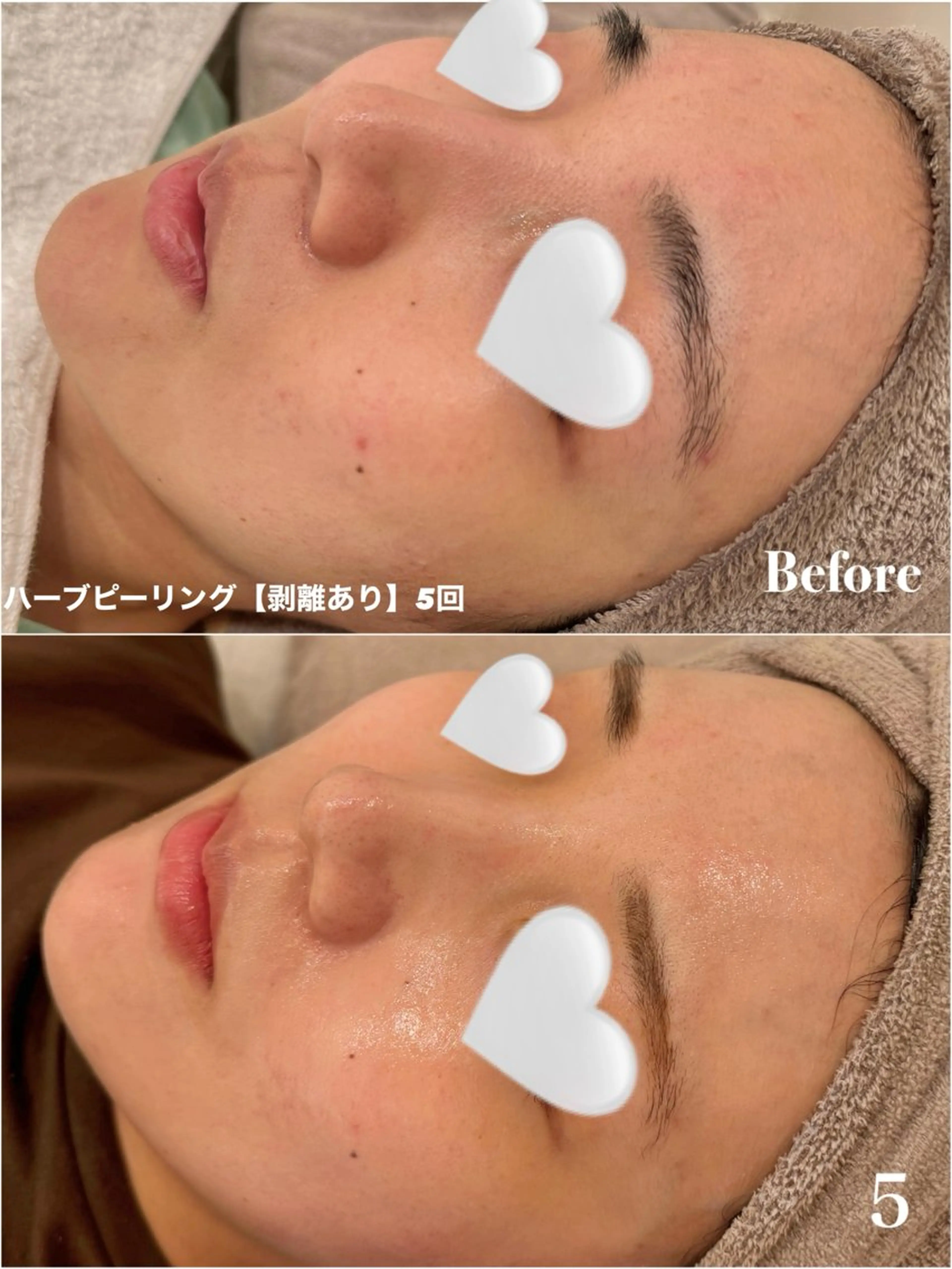 エステ Ayaka🤍 恵比寿/美容鍼/整体のエステ・リラクイメージ