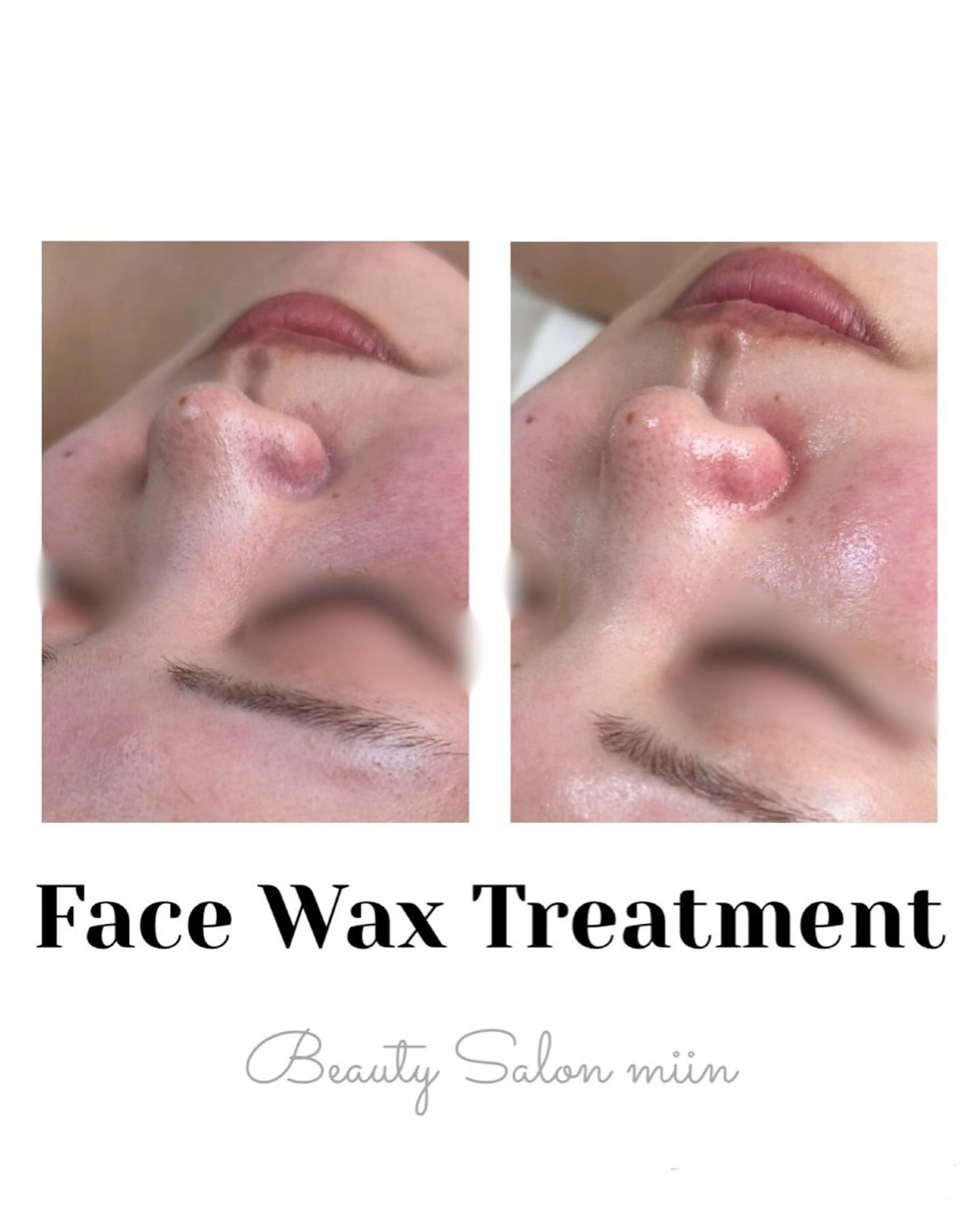 リラク 韓国肌管理 白玉肌管理®︎のエステ・リラクイメージ