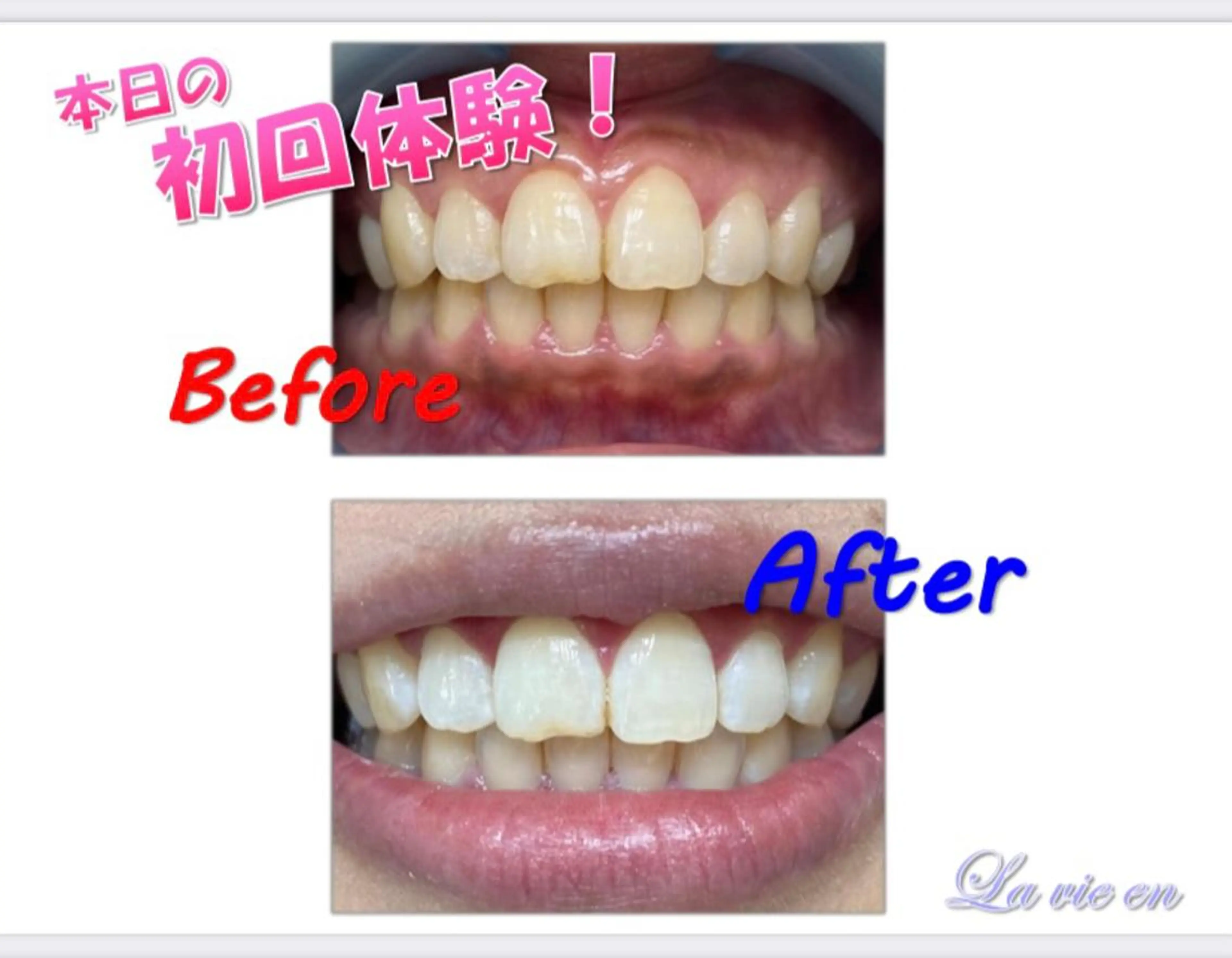 その他 セルフホワイトニングサロン　ラヴィアン所属・ホワイトニングサロン La vie enのその他イメージ