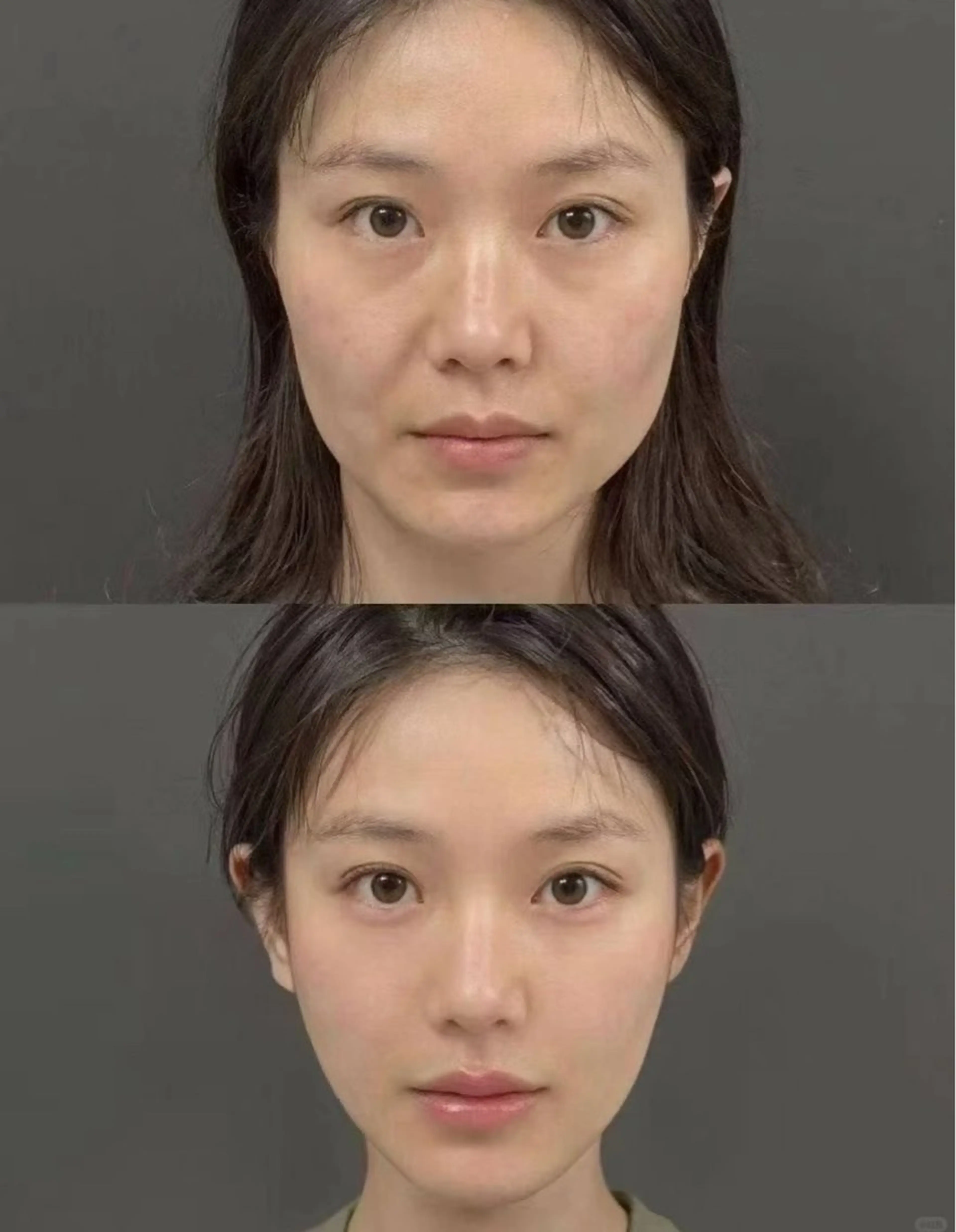 ショート aliaハーブ水光店 エステティシャン募集のエステ・リラクイメージ