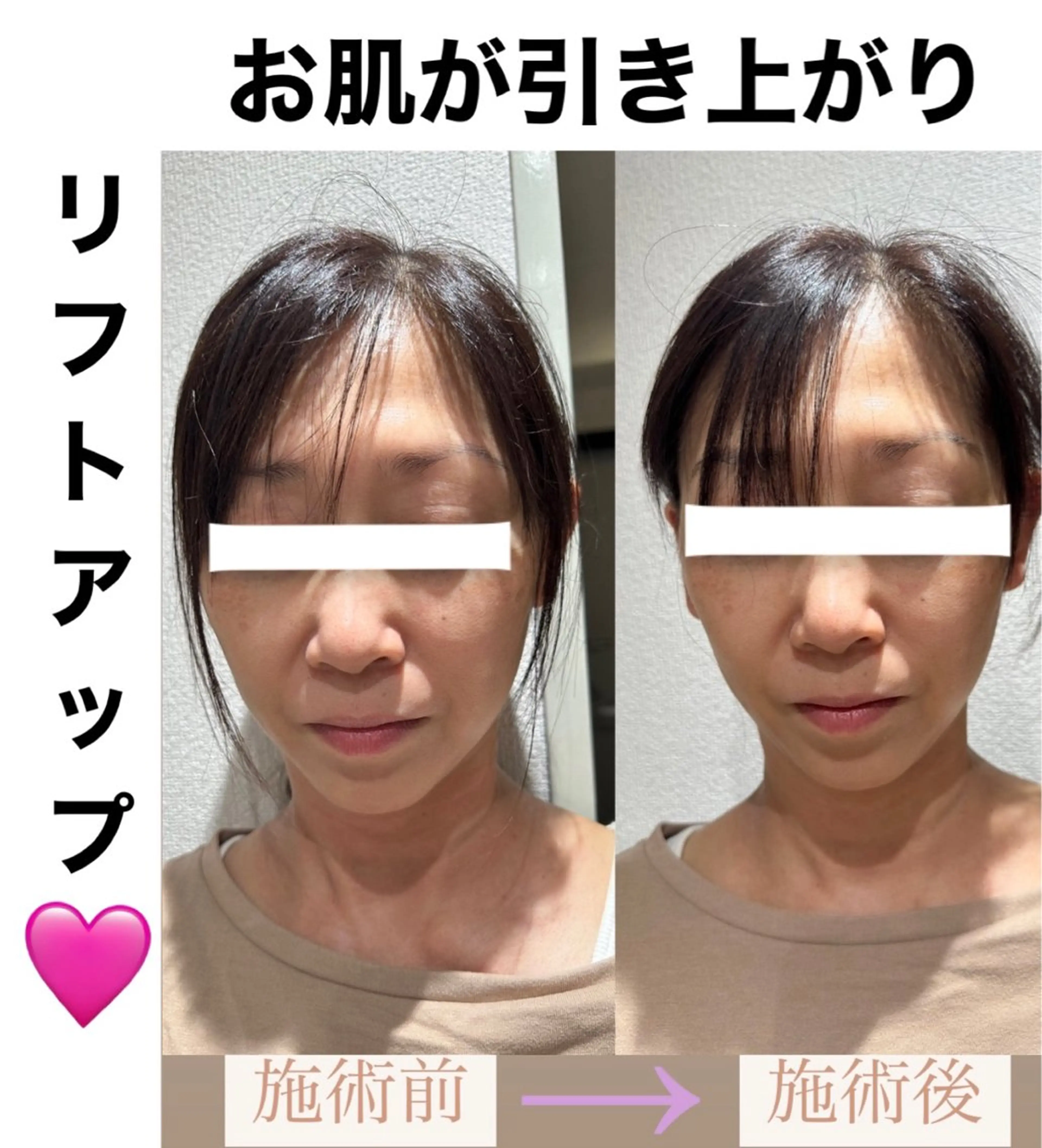 脱毛&美容サロン BLUESEAのエステ・リラクイメージ