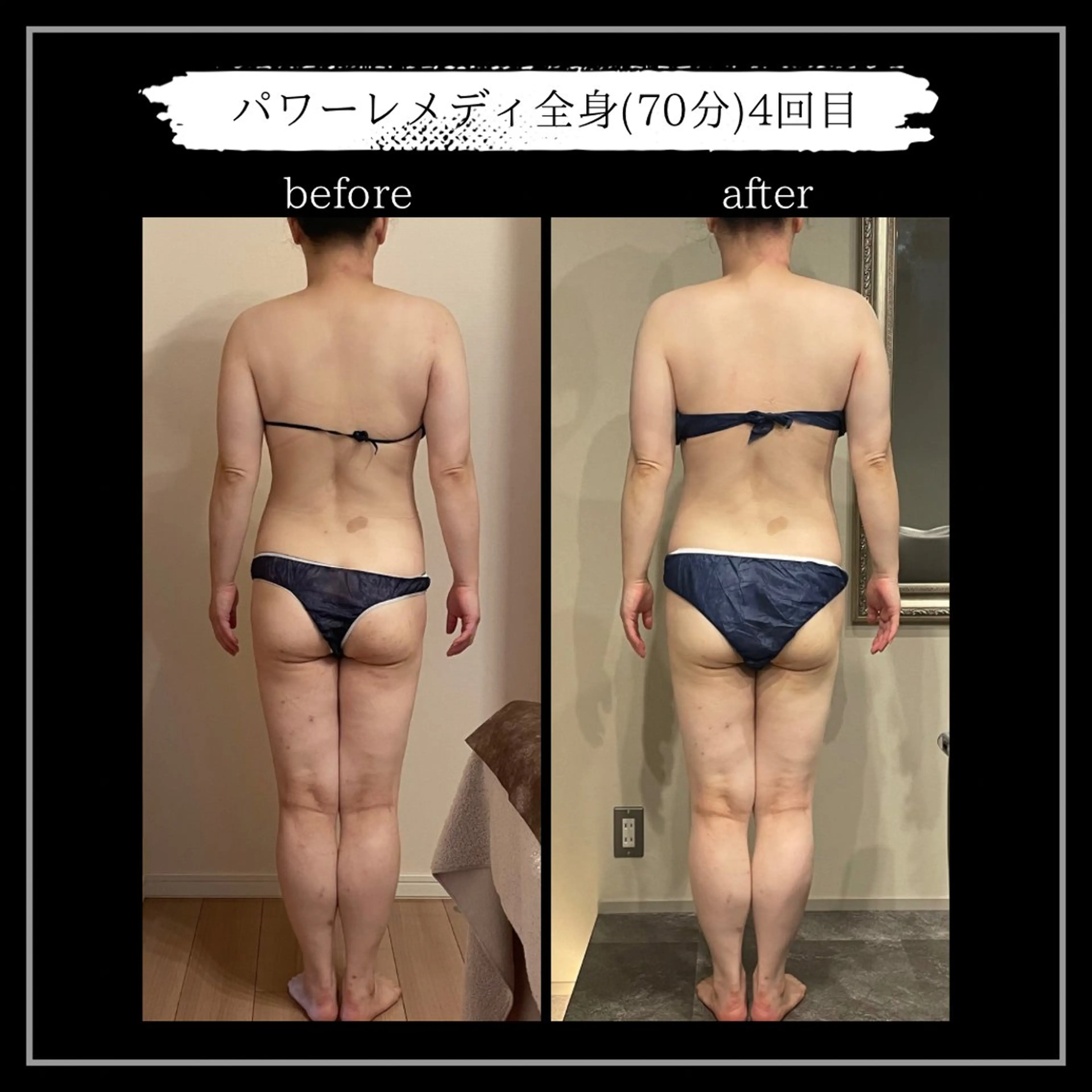 オフ:オン 全身筋膜マッサージのエステ・リラクイメージ