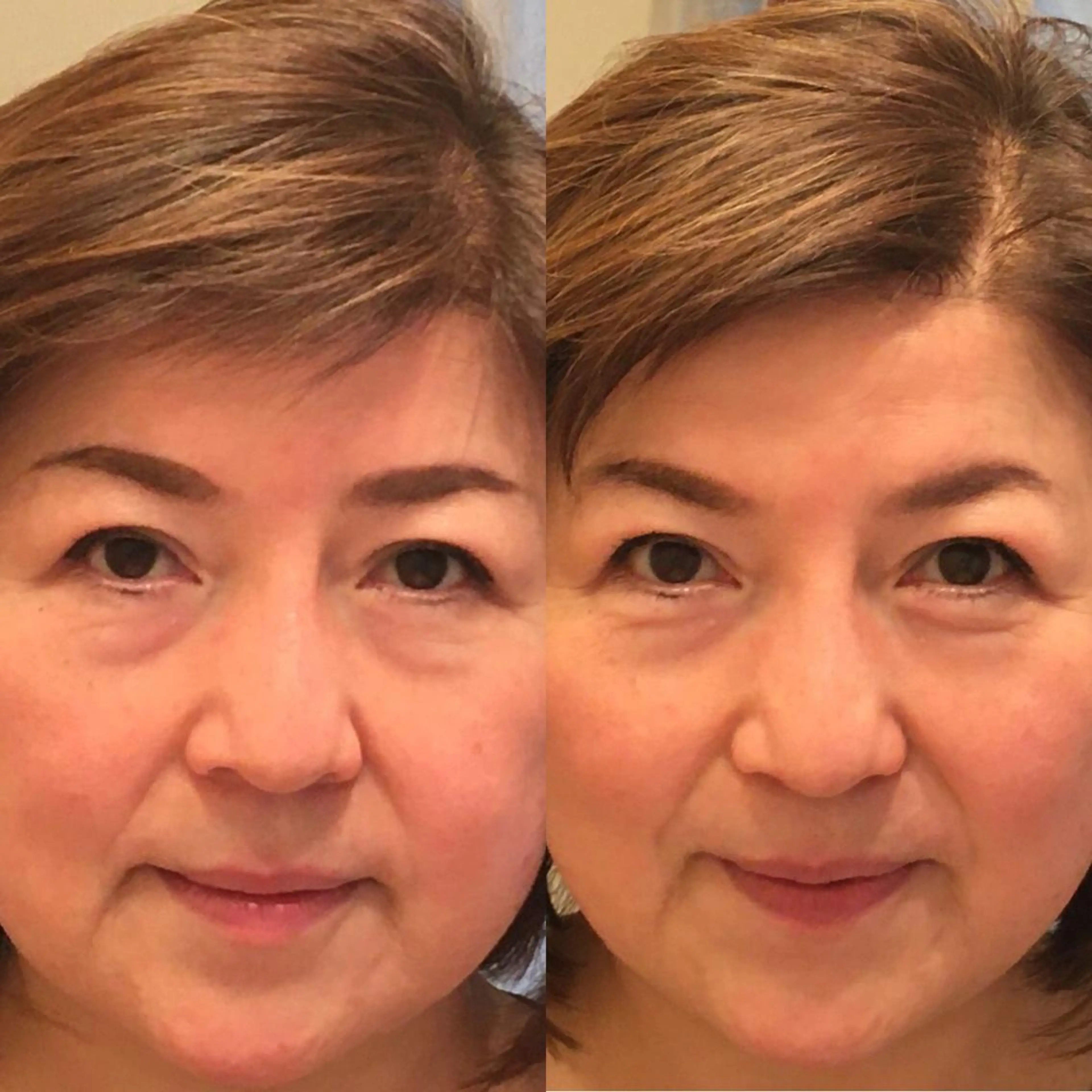 最新4Dシャワー全顔打ち放題❤️初回3500円の写真