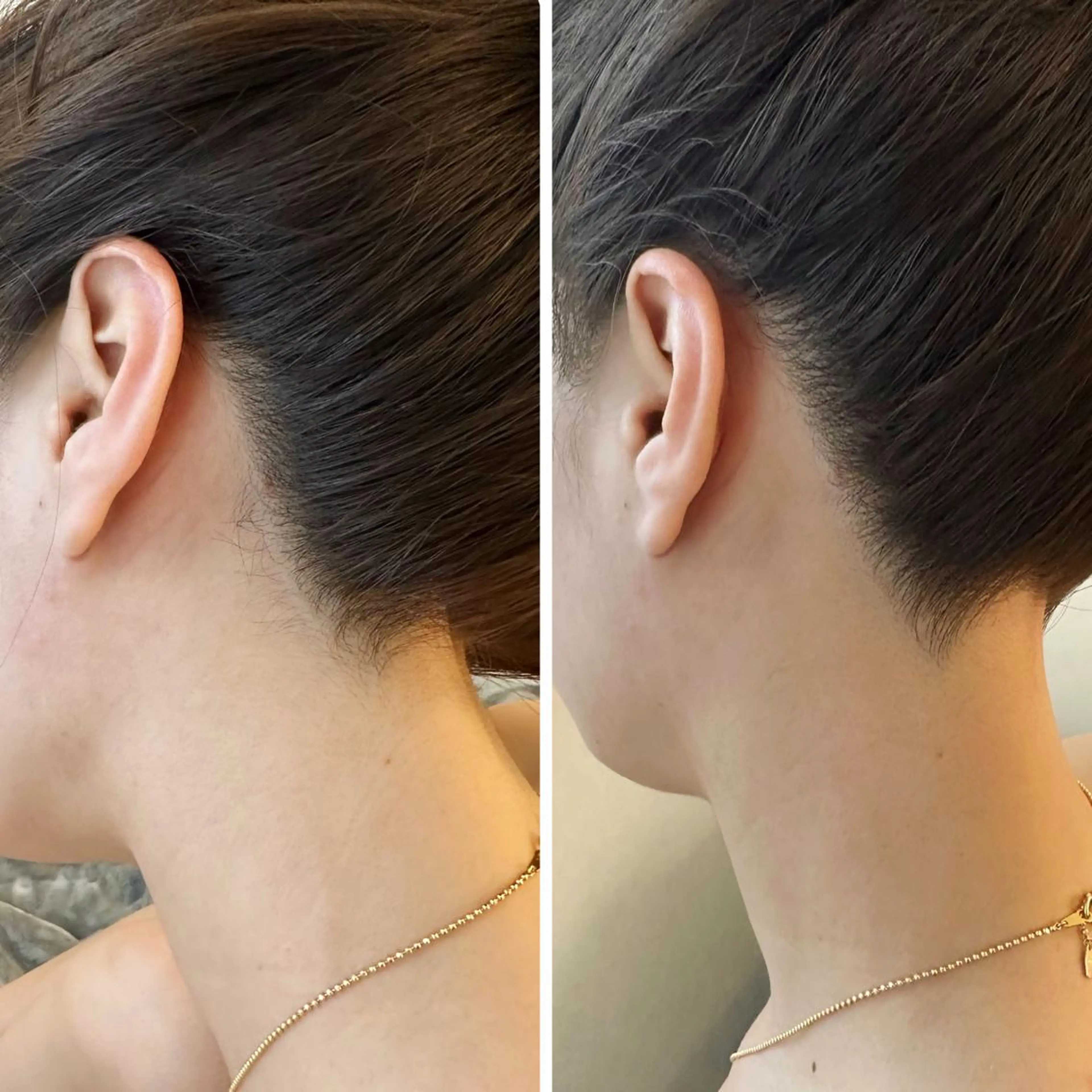 うなじ脱毛/美肌脱毛 LABELのエステ・リラクイメージ