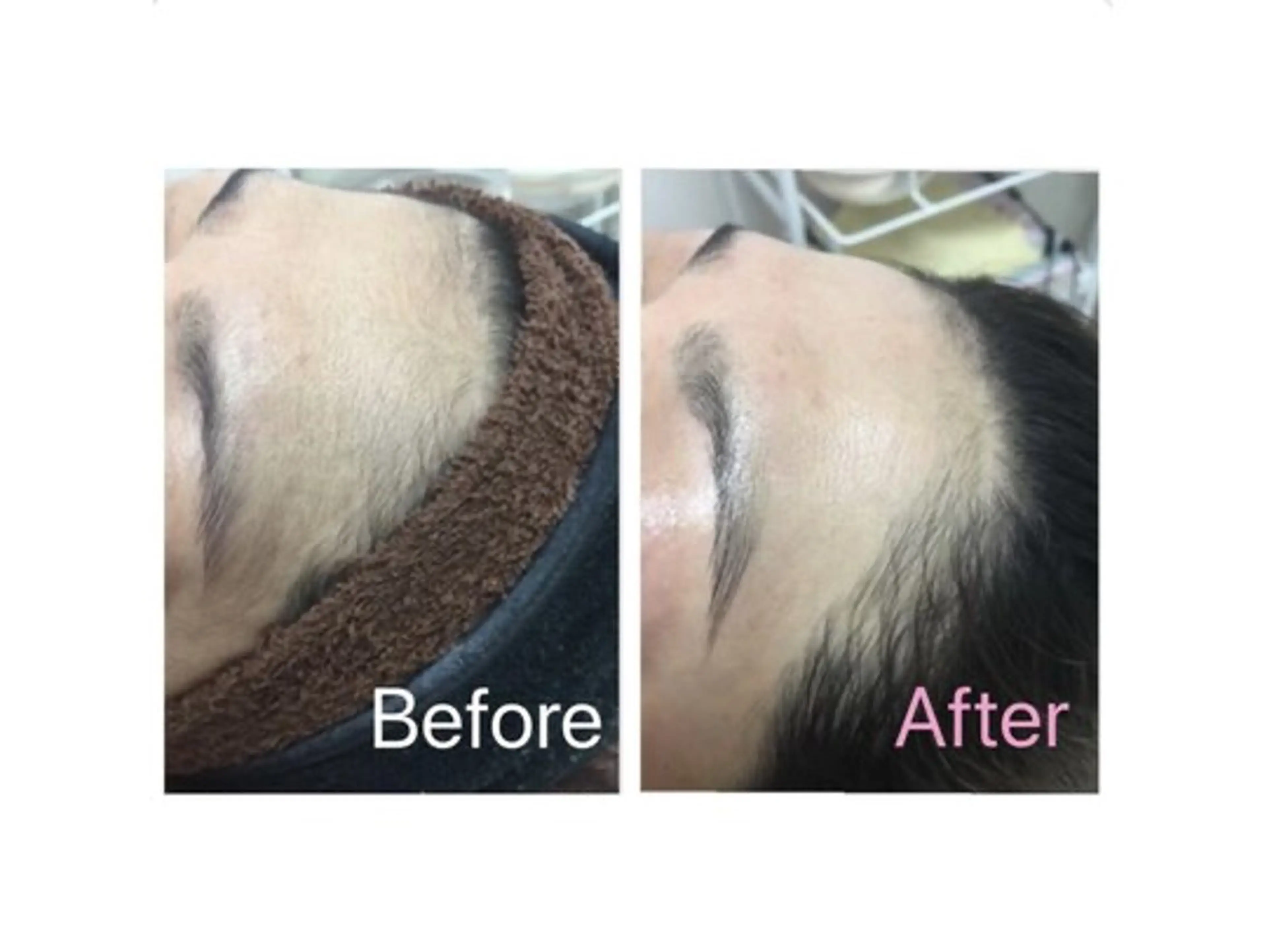 アイブロウ 脱毛 BRILLIANCE ブリリアンスのエステ・リラクイメージ