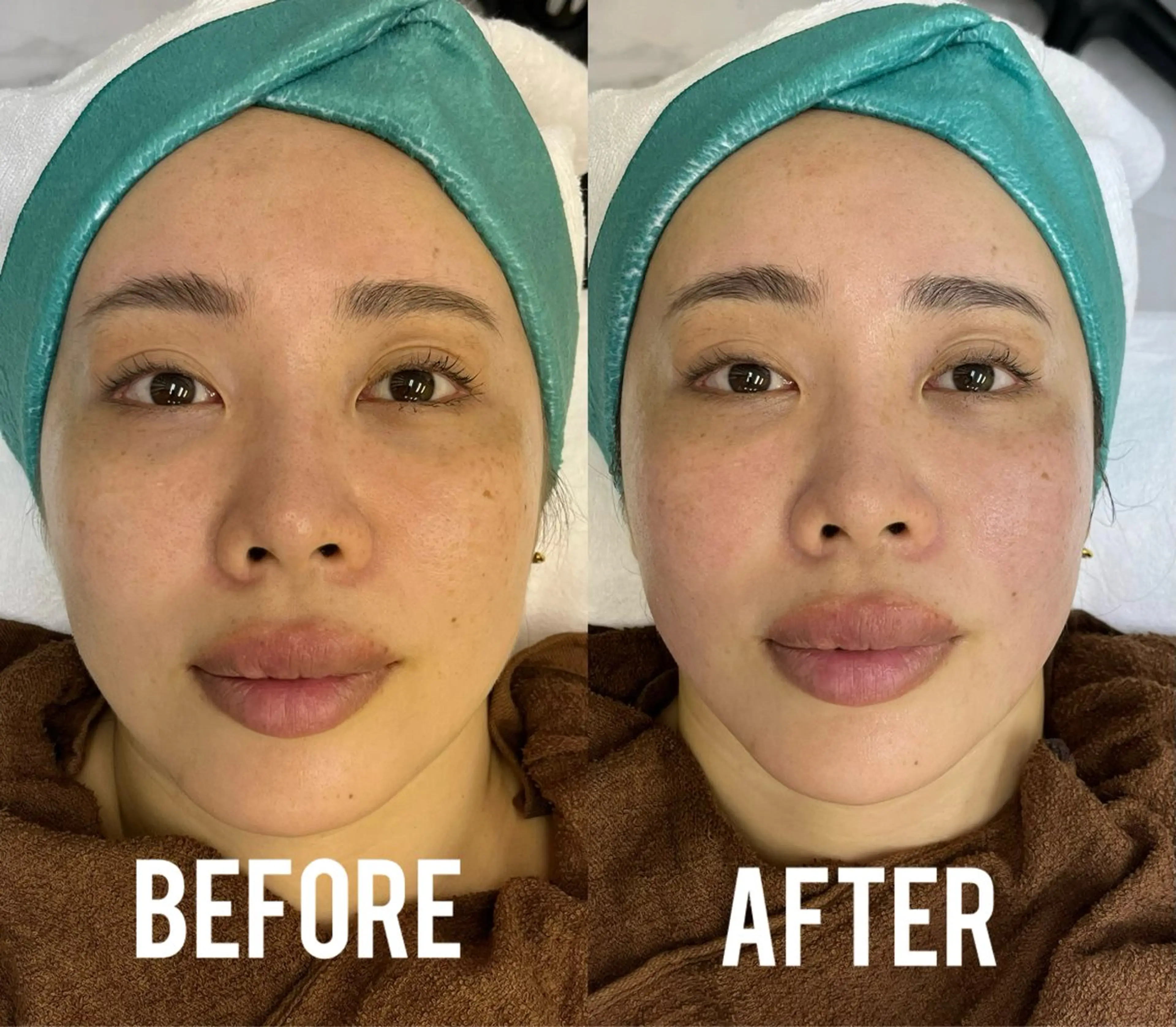 エステ 小顔、毛穴ケア 通い放題エステのエステ・リラクイメージ