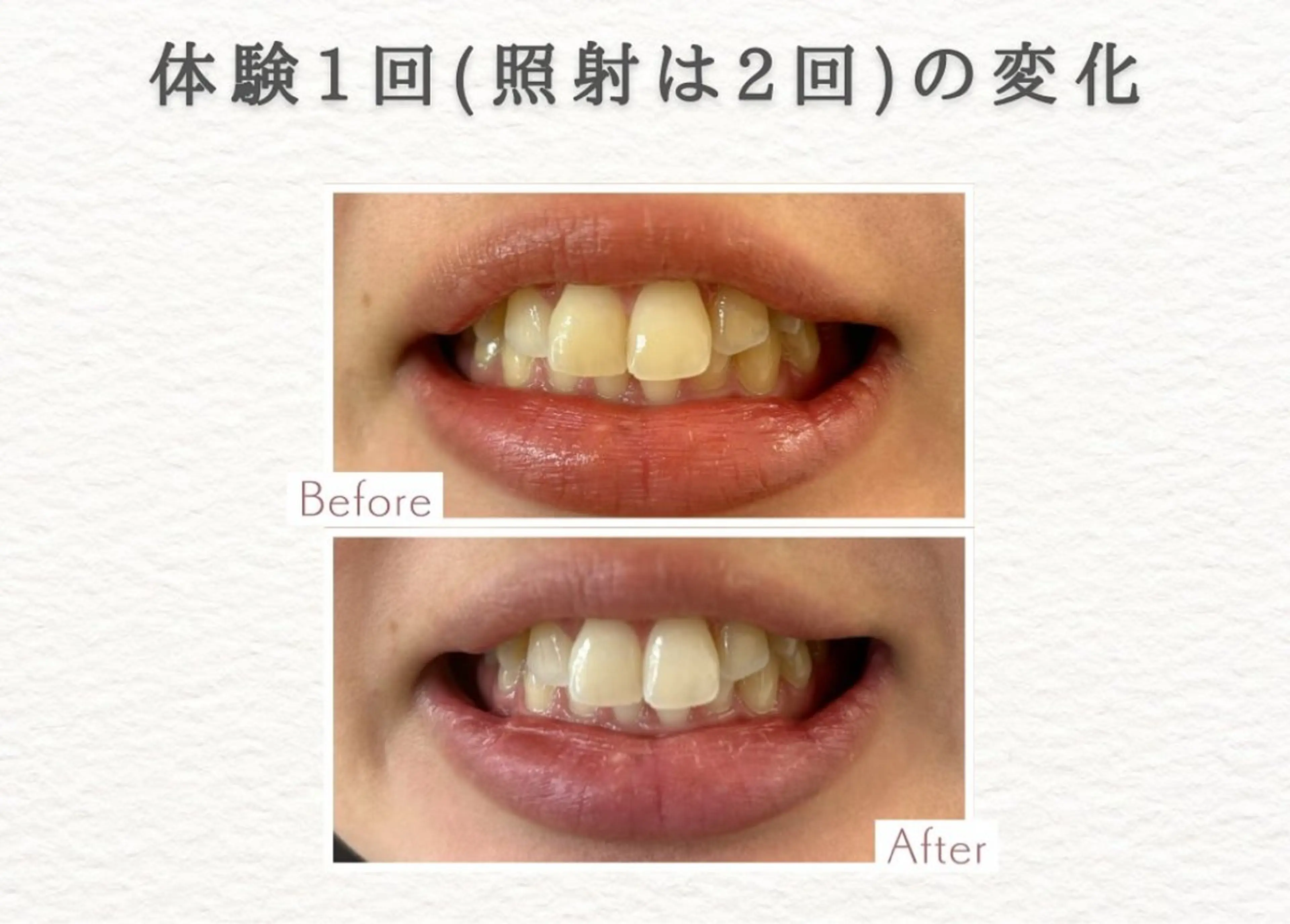 その他 セルフホワイトニングエクシア小山店所属・セルフホワイトニング エクシア小山店のその他イメージ