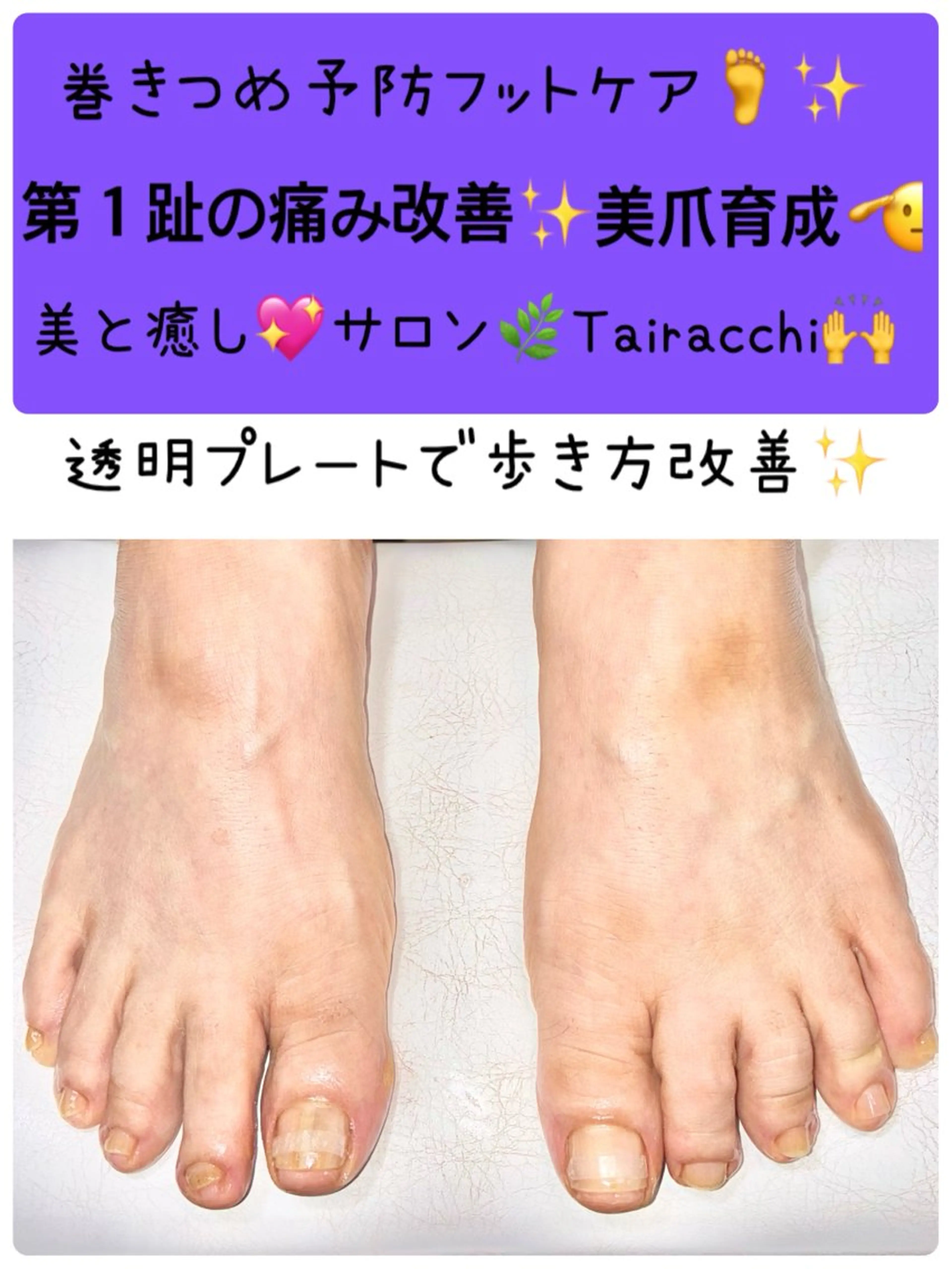 ネイル フットネイル Tairacchi タイラッチのエステ・リラクイメージ