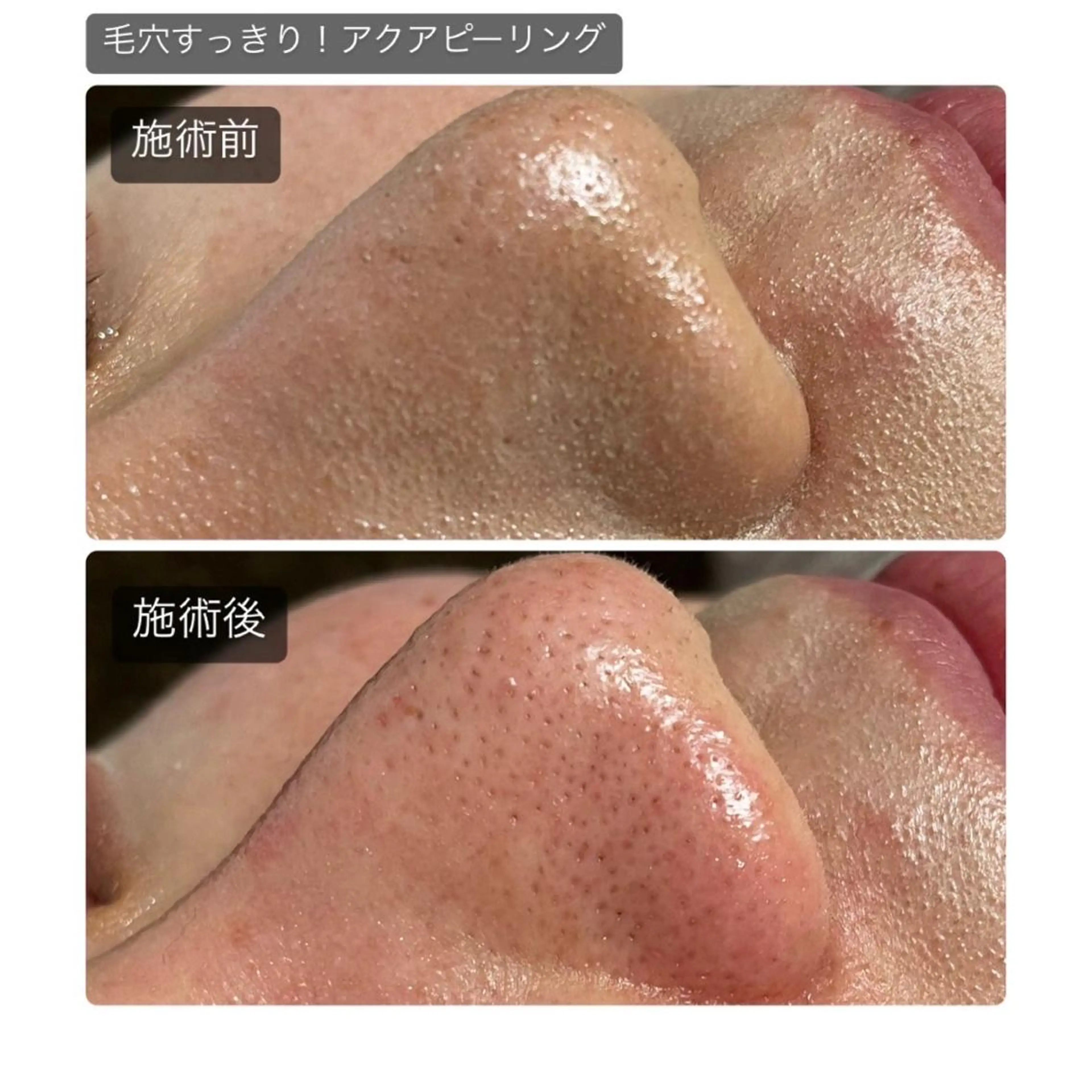 心斎橋痩身ダイエット 韓国.美容鍼.小顔のエステ・リラクイメージ