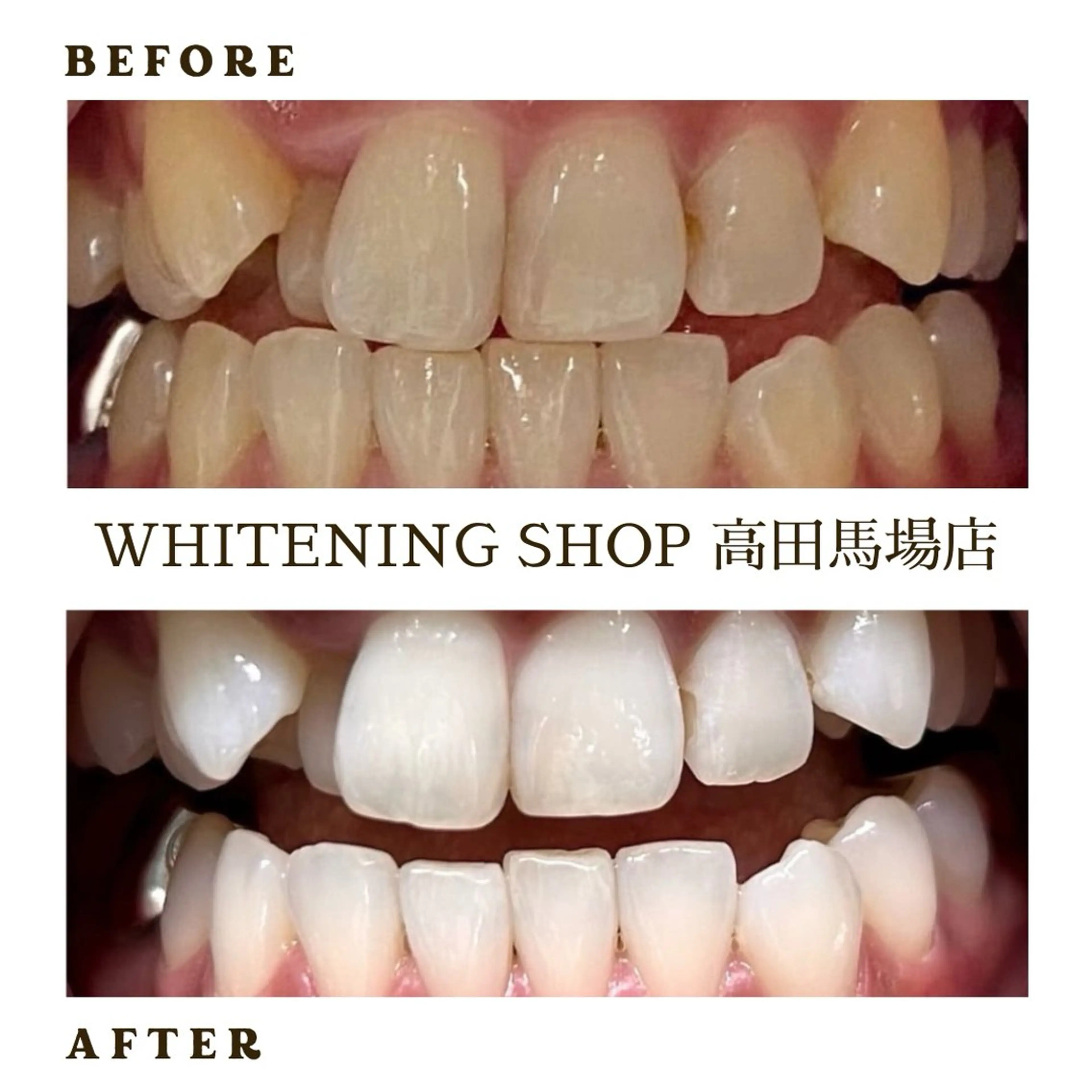 メンズ その他 ホワイトニング ショップ高田馬場店のその他イメージ