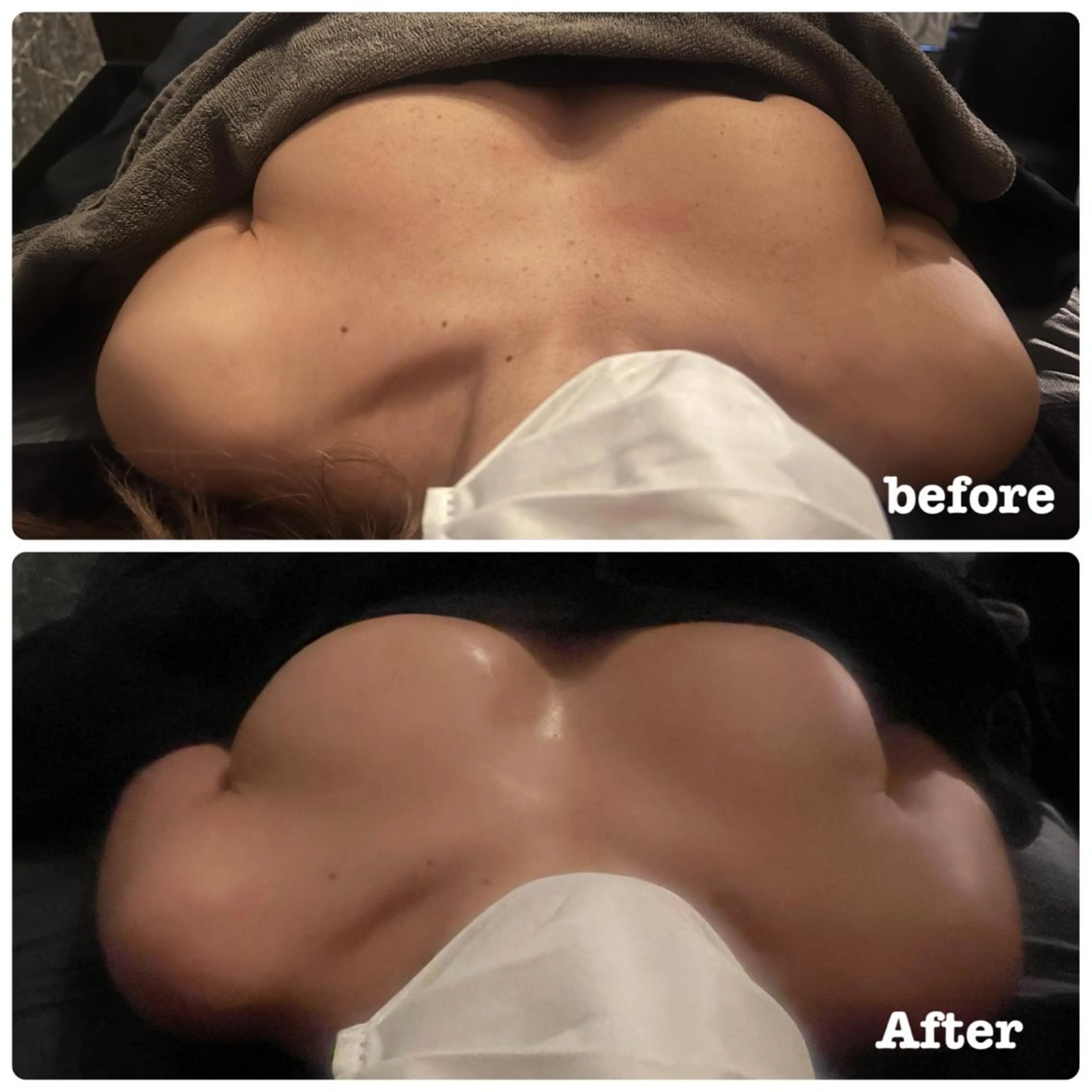 エステ Salon de CocoFranのその他イメージ