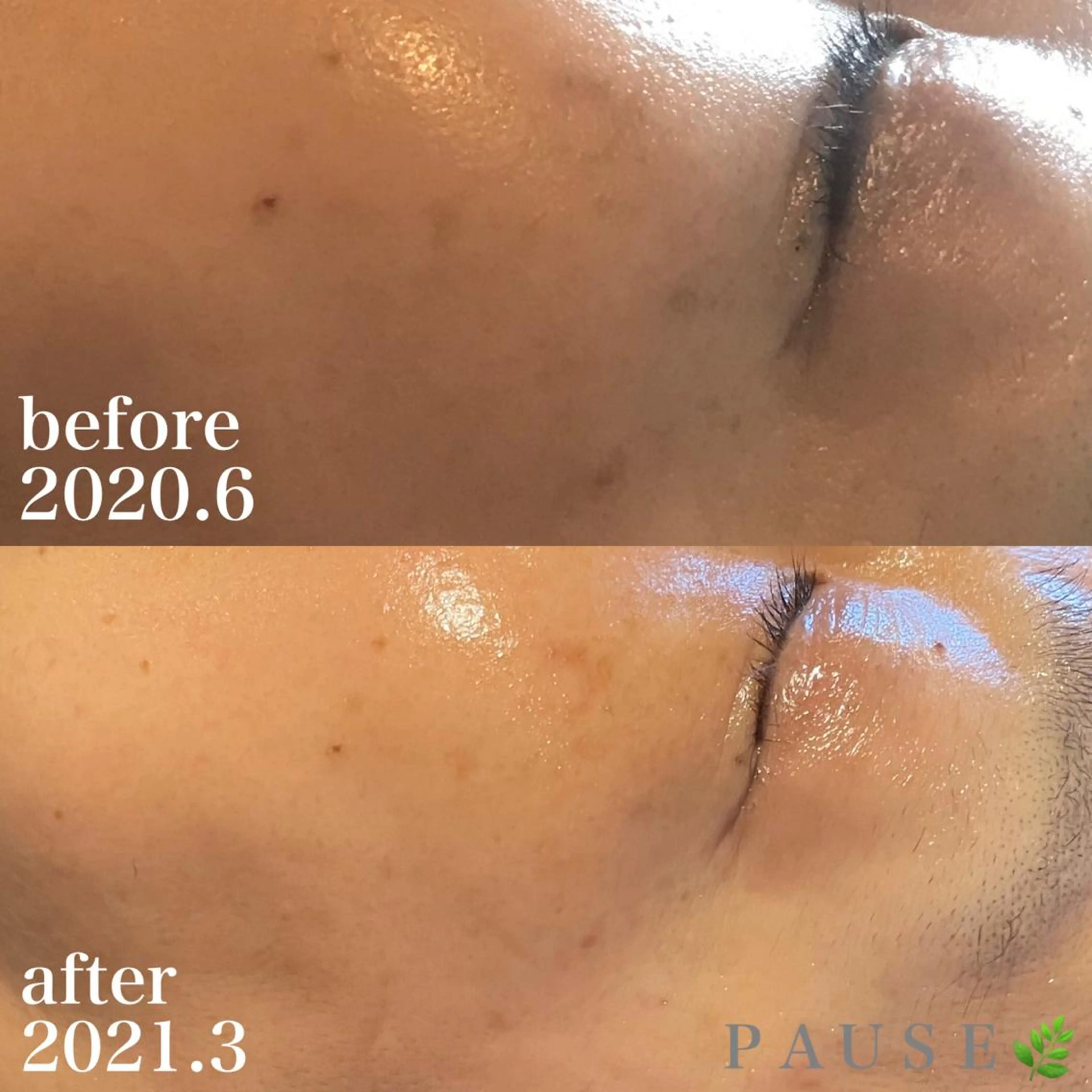 エステ 浜野 恵美のエステ・リラクイメージ