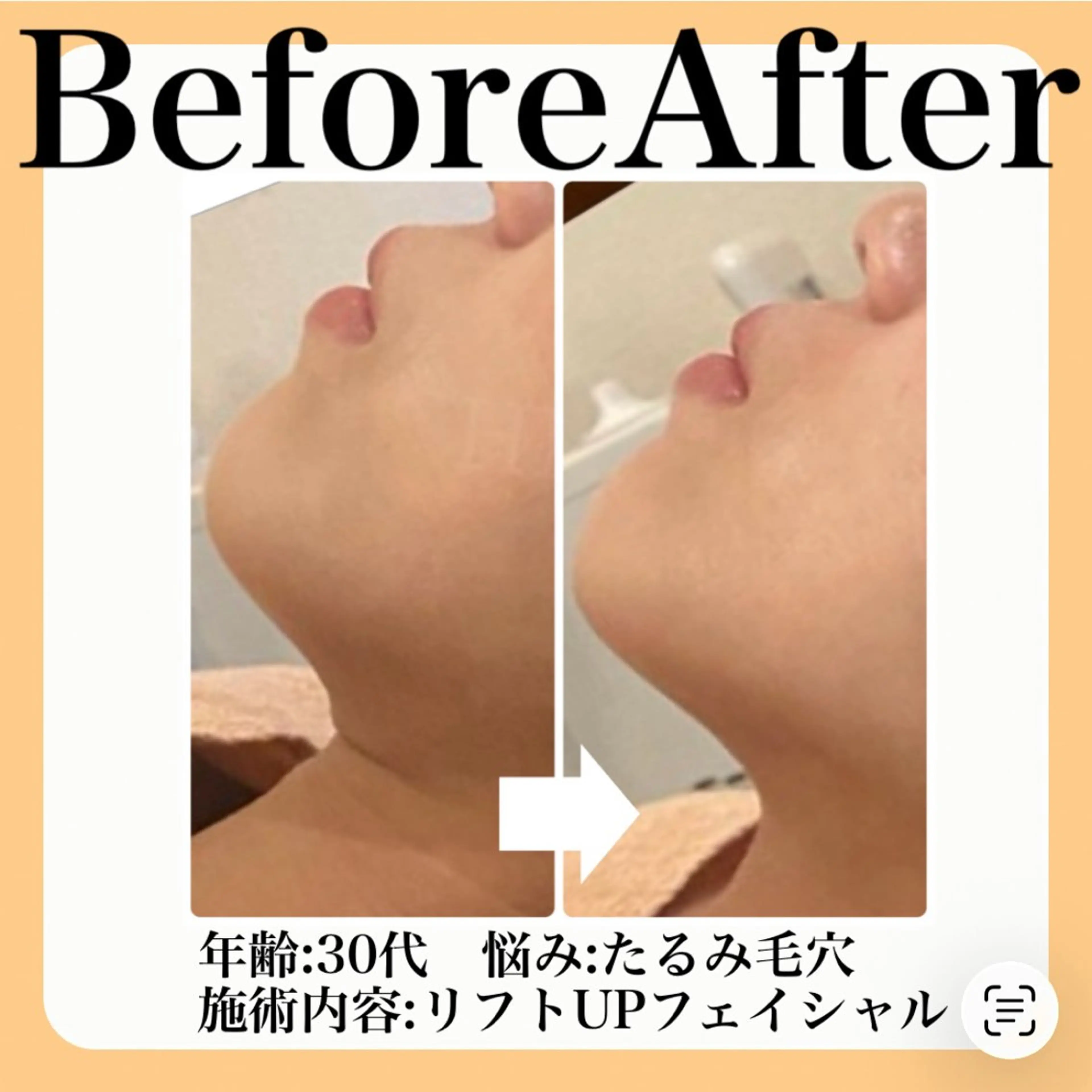 エステ 肌質改善sui所属・肌質改善 suiのエステ・リラクイメージ