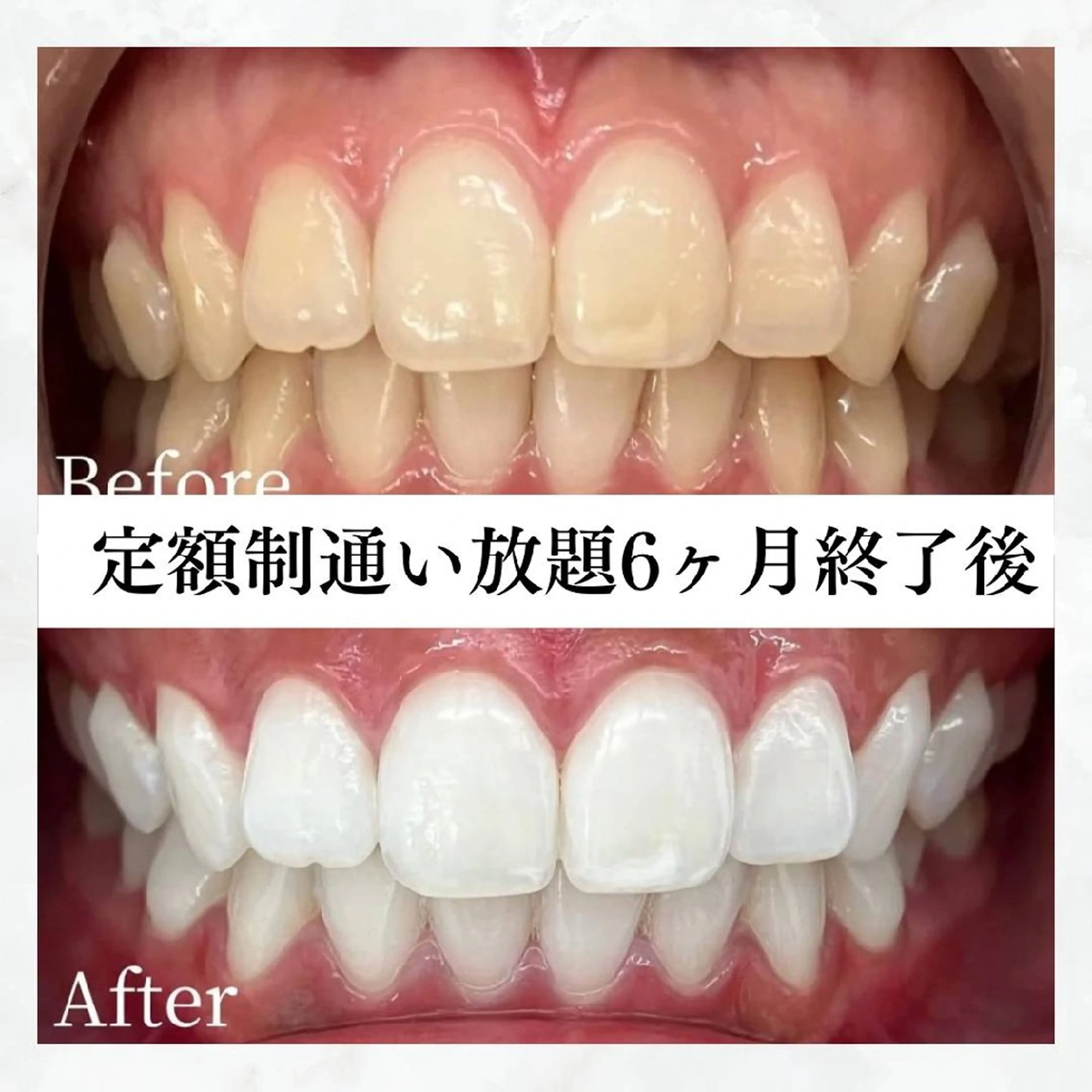 メンズ 撮影モデル セルフホワイトニング WHITE福岡博多店のエステ・リラクイメージ