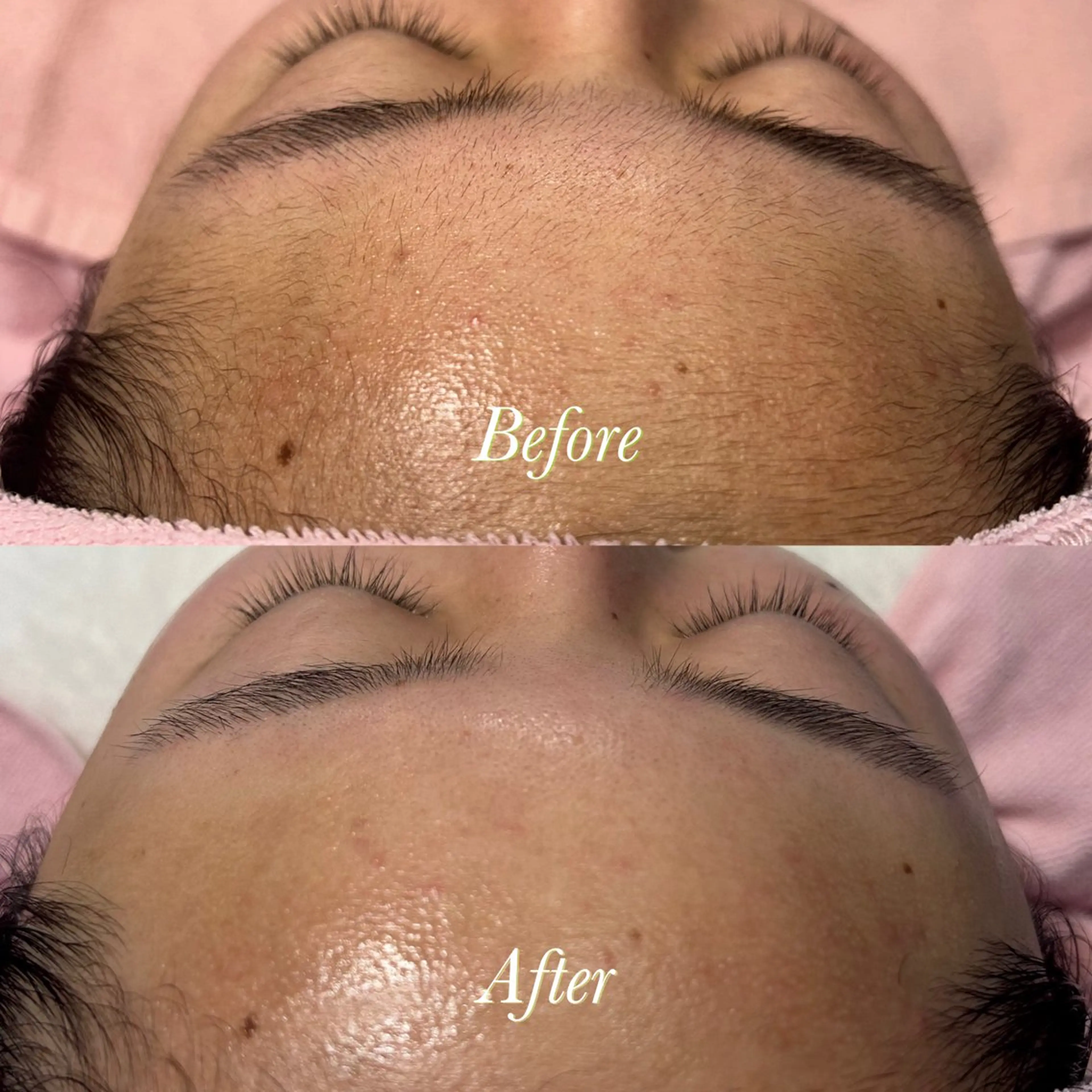 🫧美しい素肌へ🫧 今成柚乃のその他イメージ