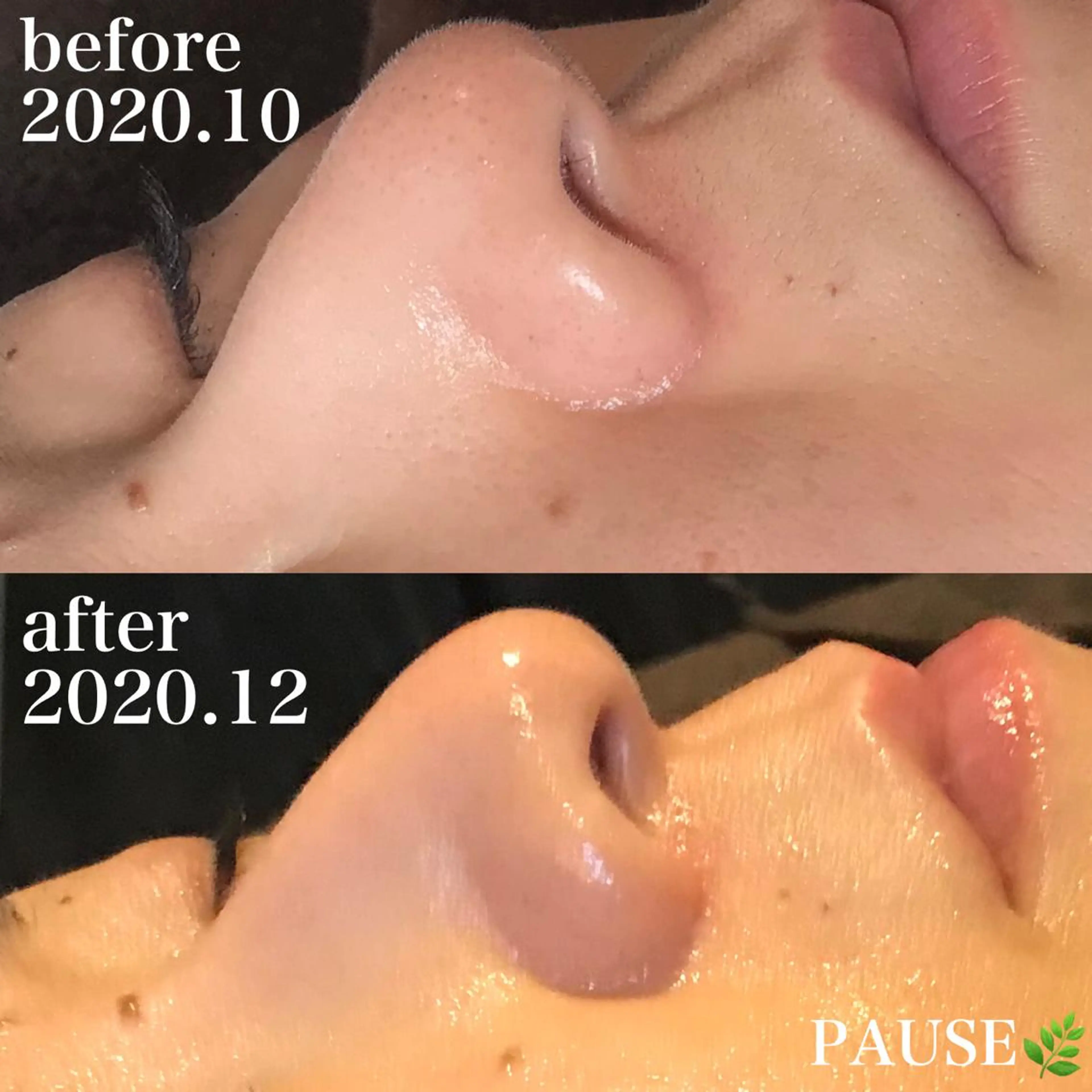 エステ 浜野 恵美のエステ・リラクイメージ