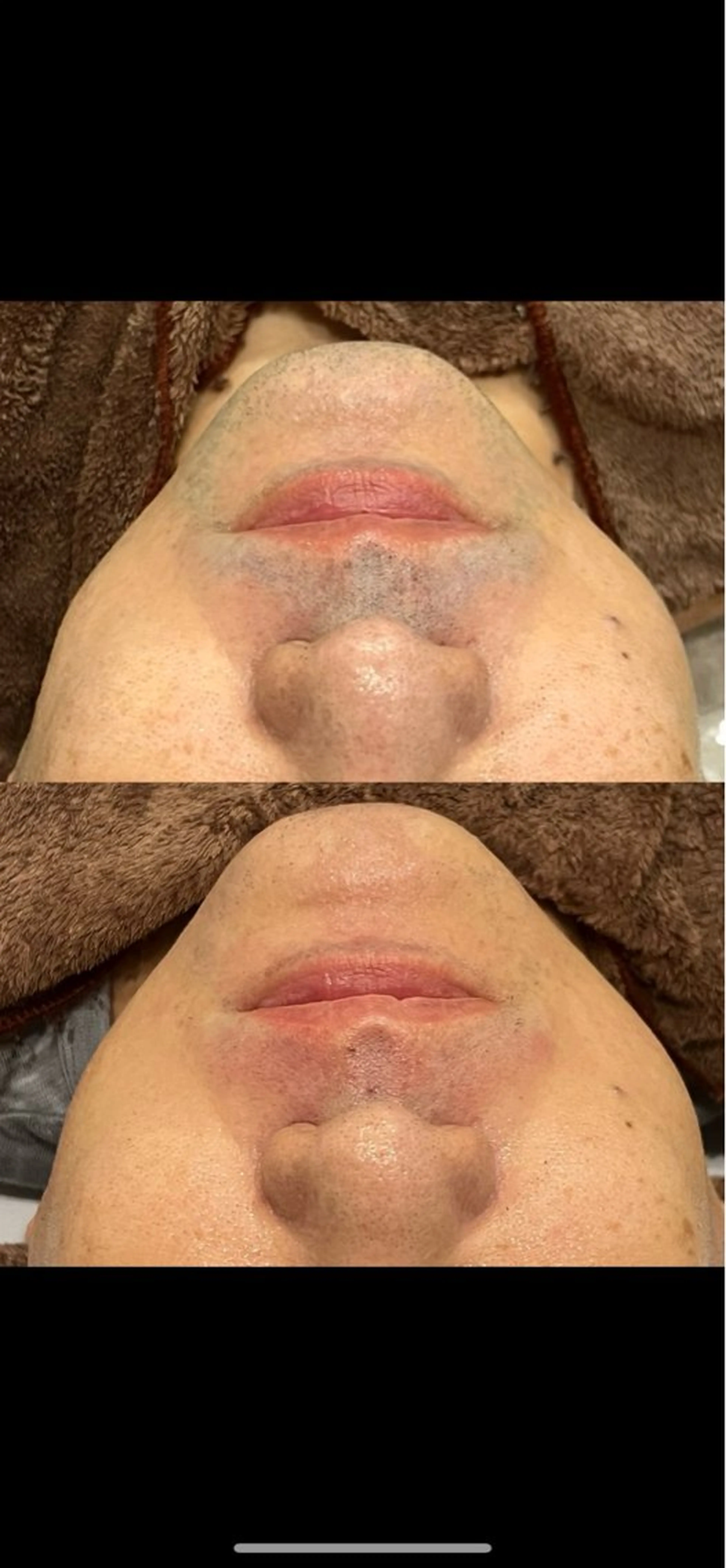 メンズ 脱毛 岡田 朱音のエステ・リラクイメージ