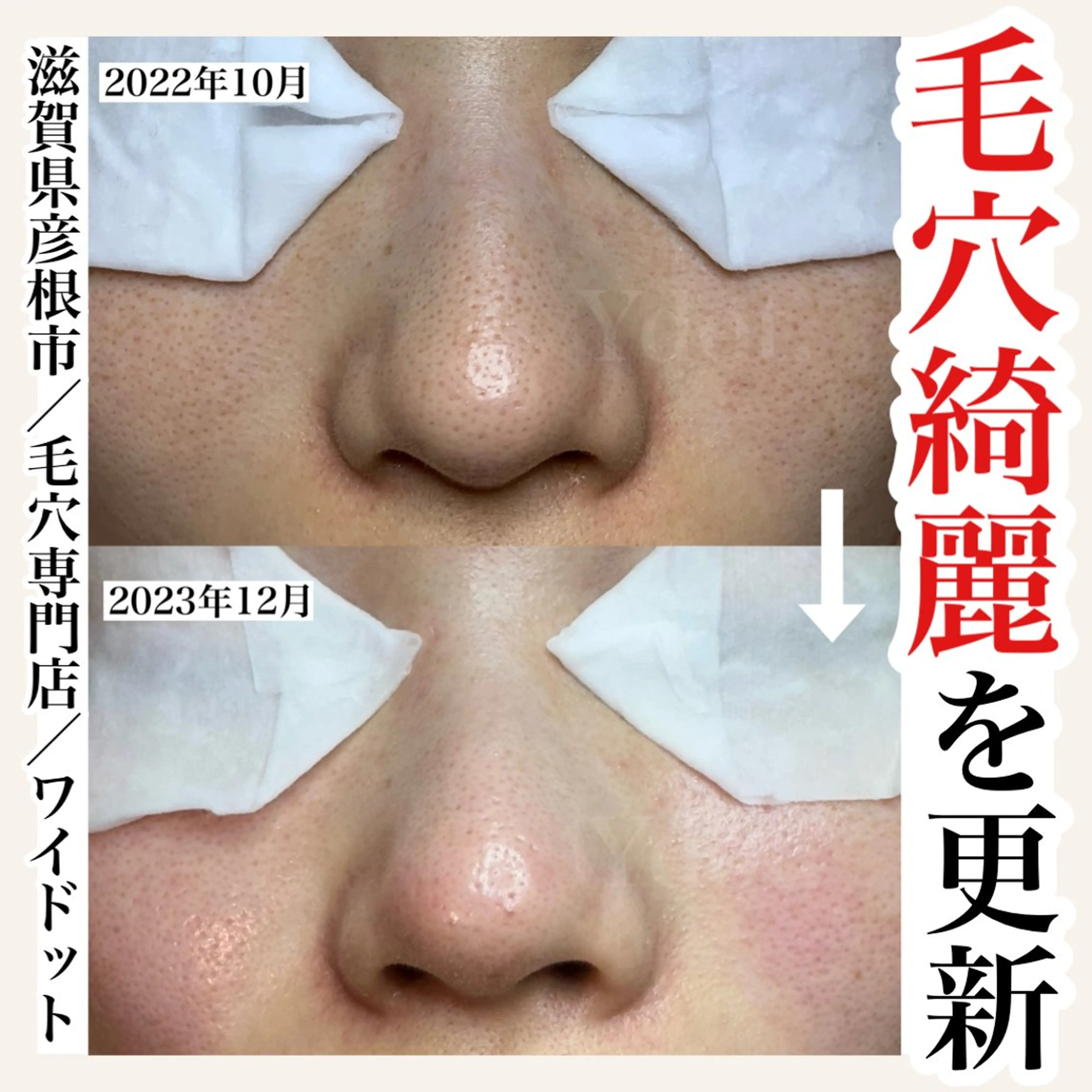 エステ Ydot. 池内 友架のエステ・リラクイメージ