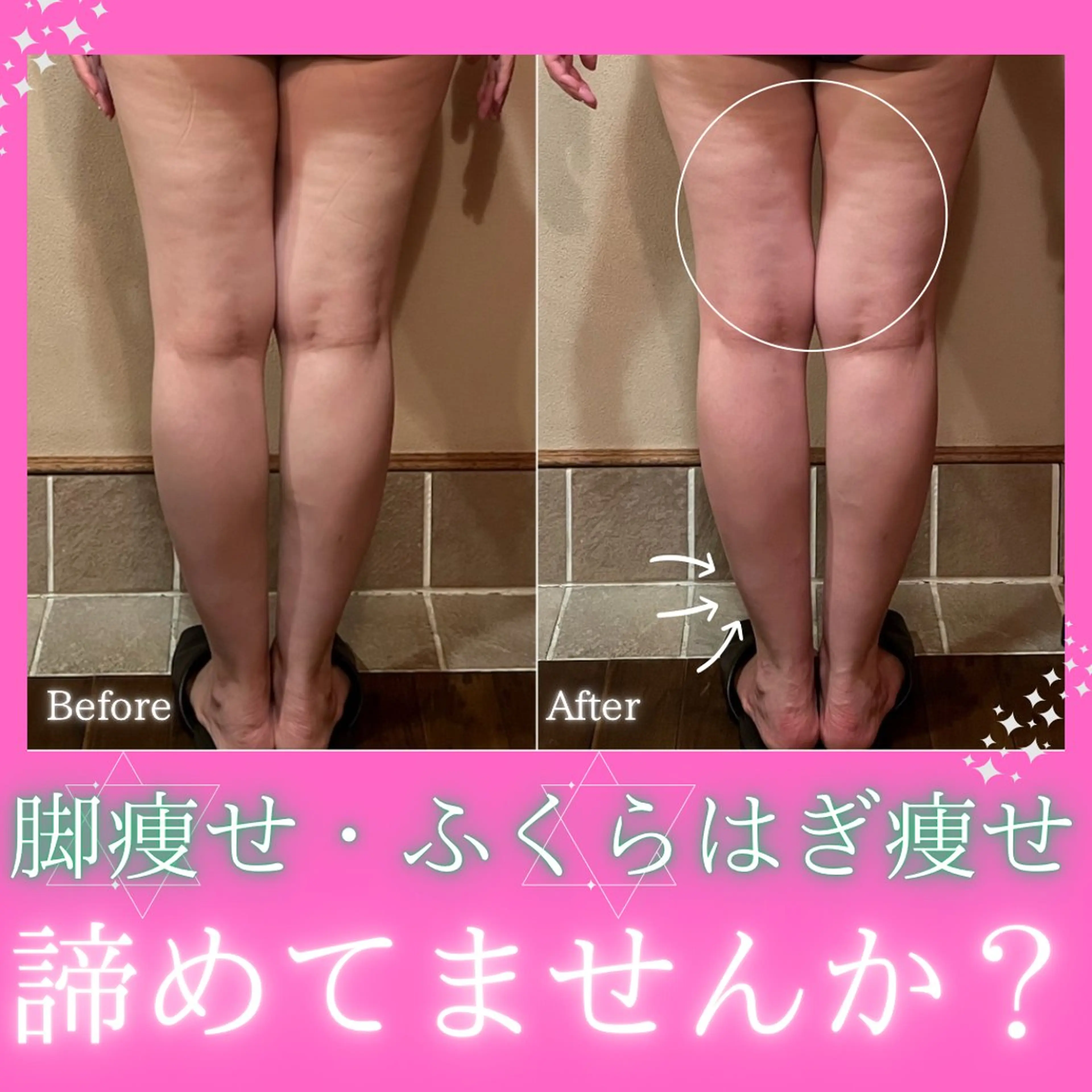 その他 痩身&美肌サロン 堀米✨のその他イメージ