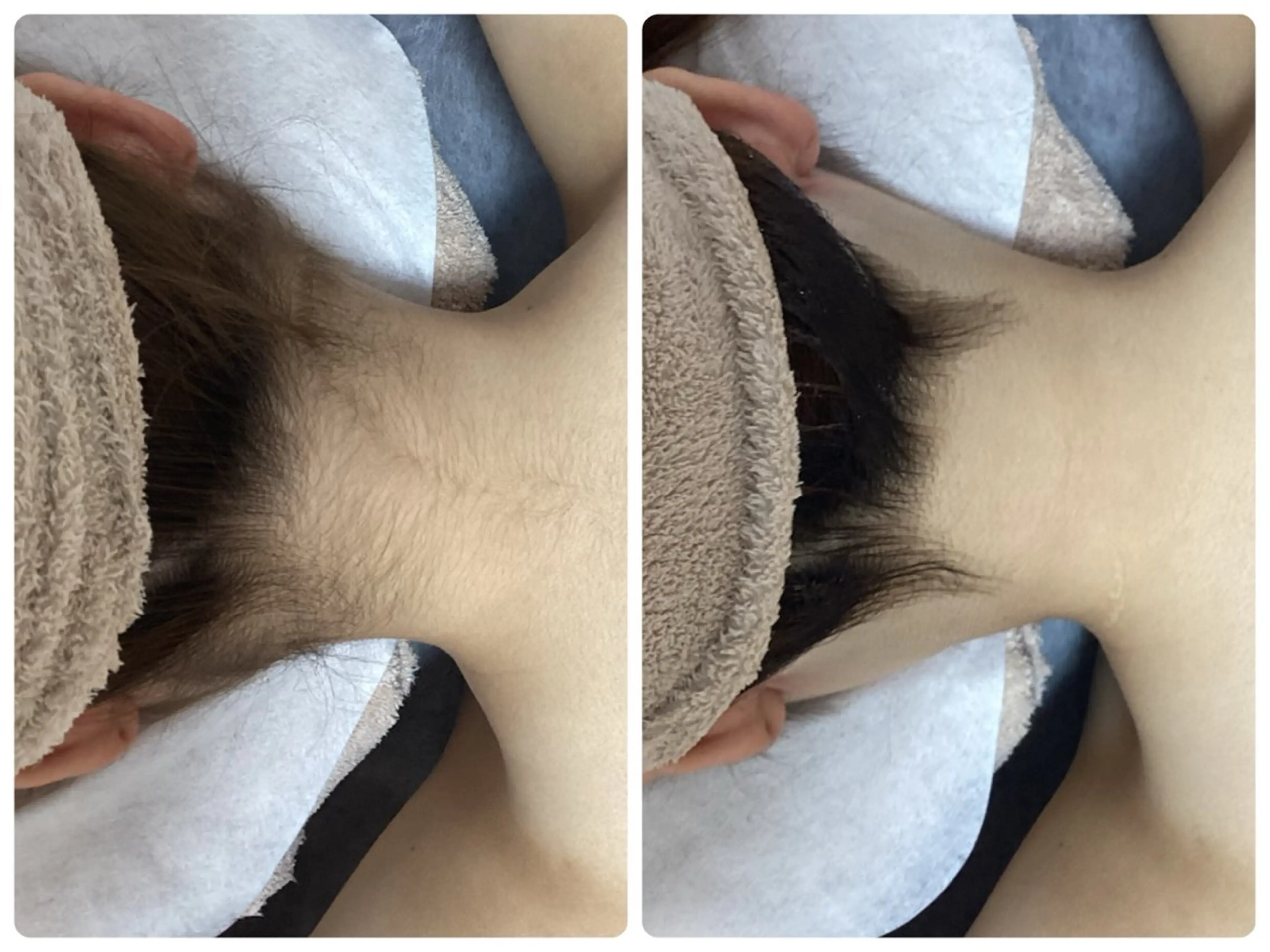 脱毛 脱毛専門減毛サロン LULU.tokyoのエステ・リラクイメージ