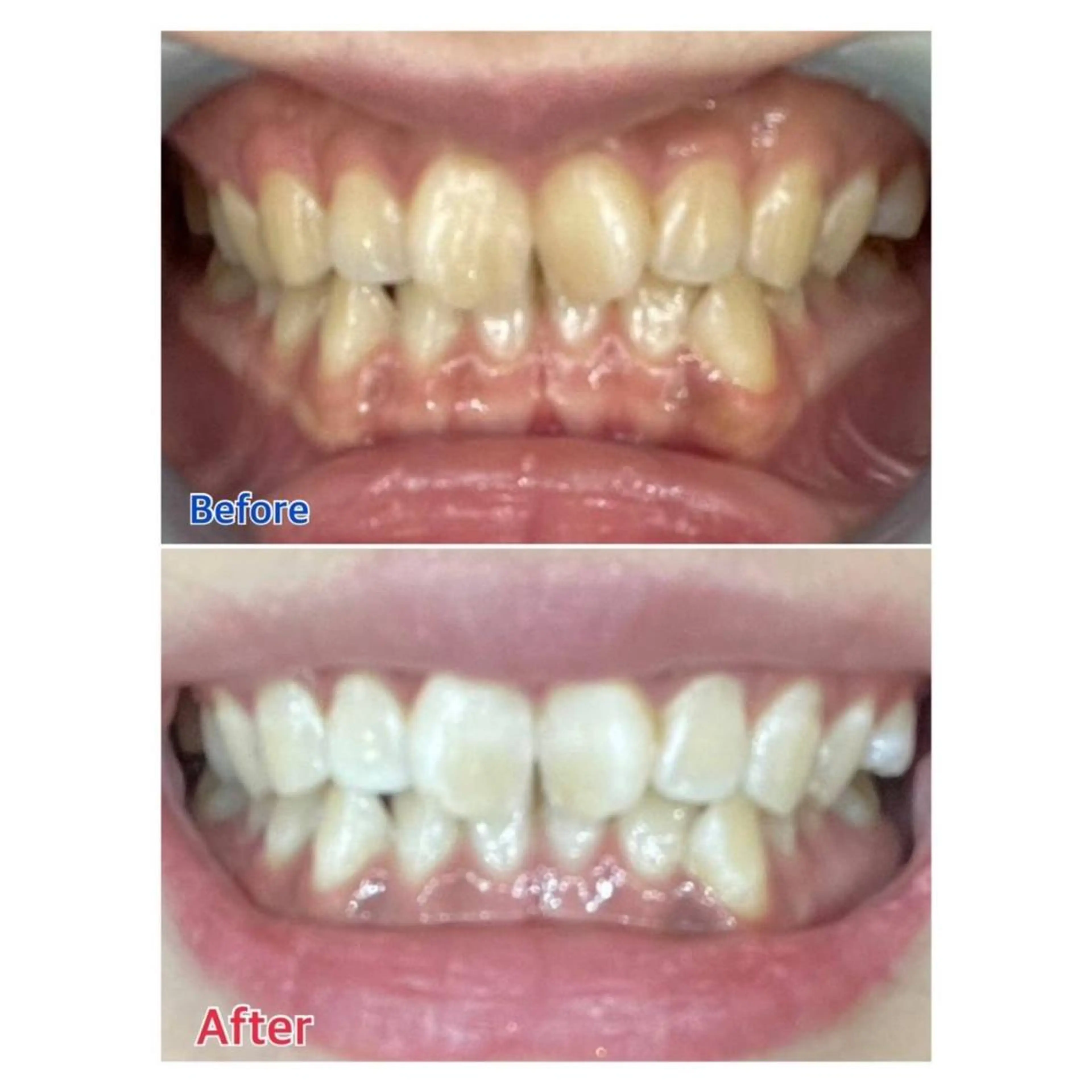 Melty 輝のその他イメージ