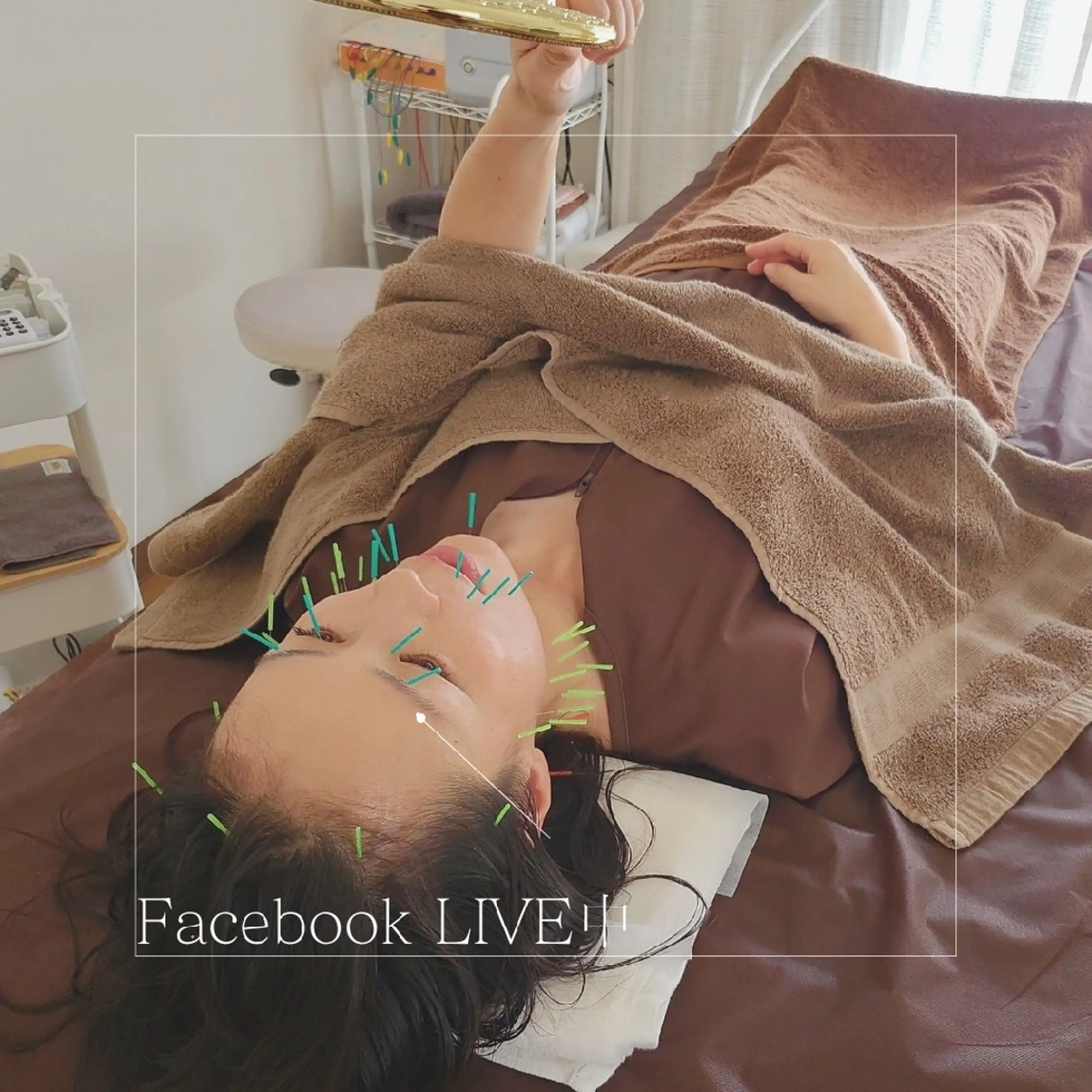 即効⚡小顔美容鍼🪡 むくみたるみ脂肪解消のエステ・リラクイメージ