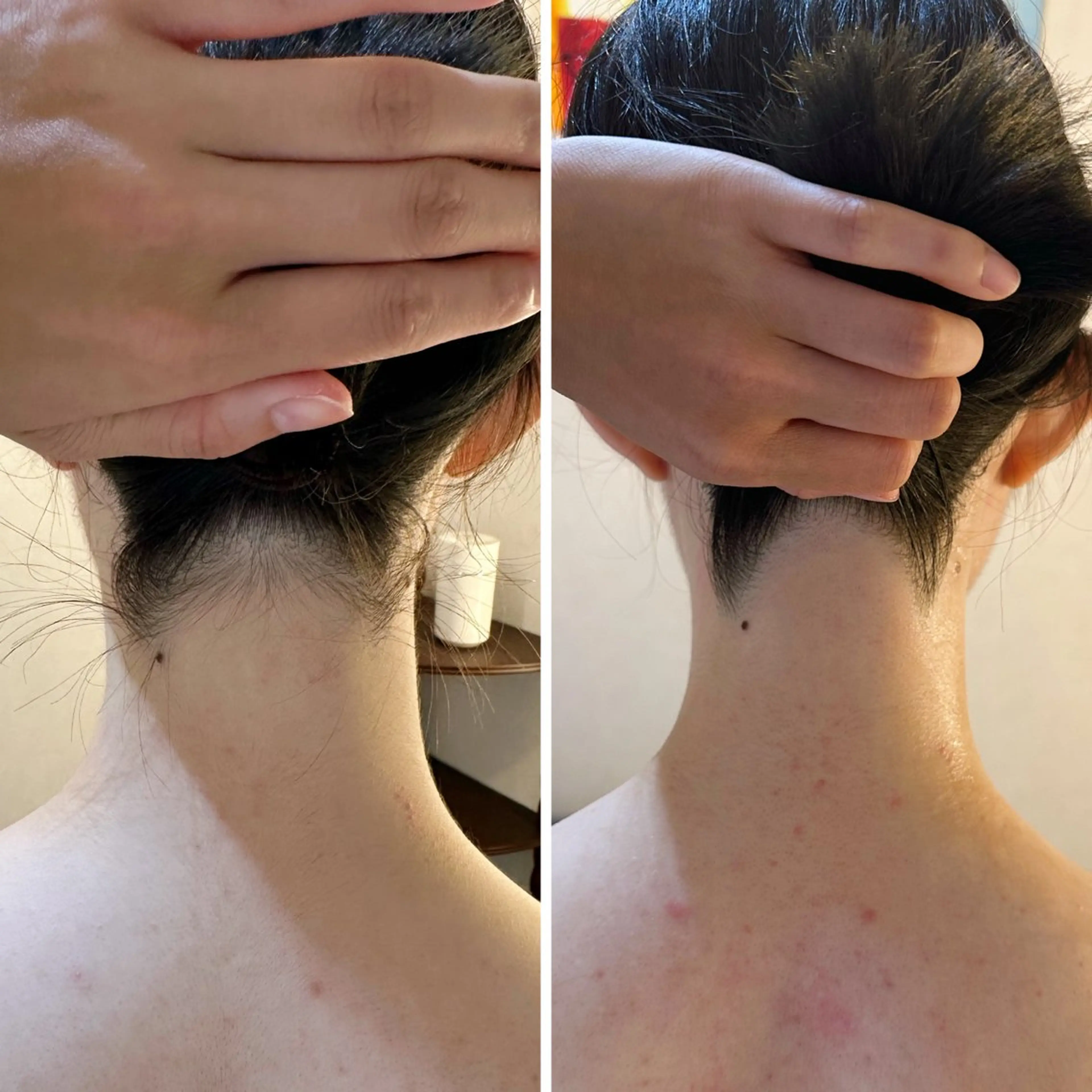 脱毛 うなじ脱毛/美肌脱毛 LABELのエステ・リラクイメージ