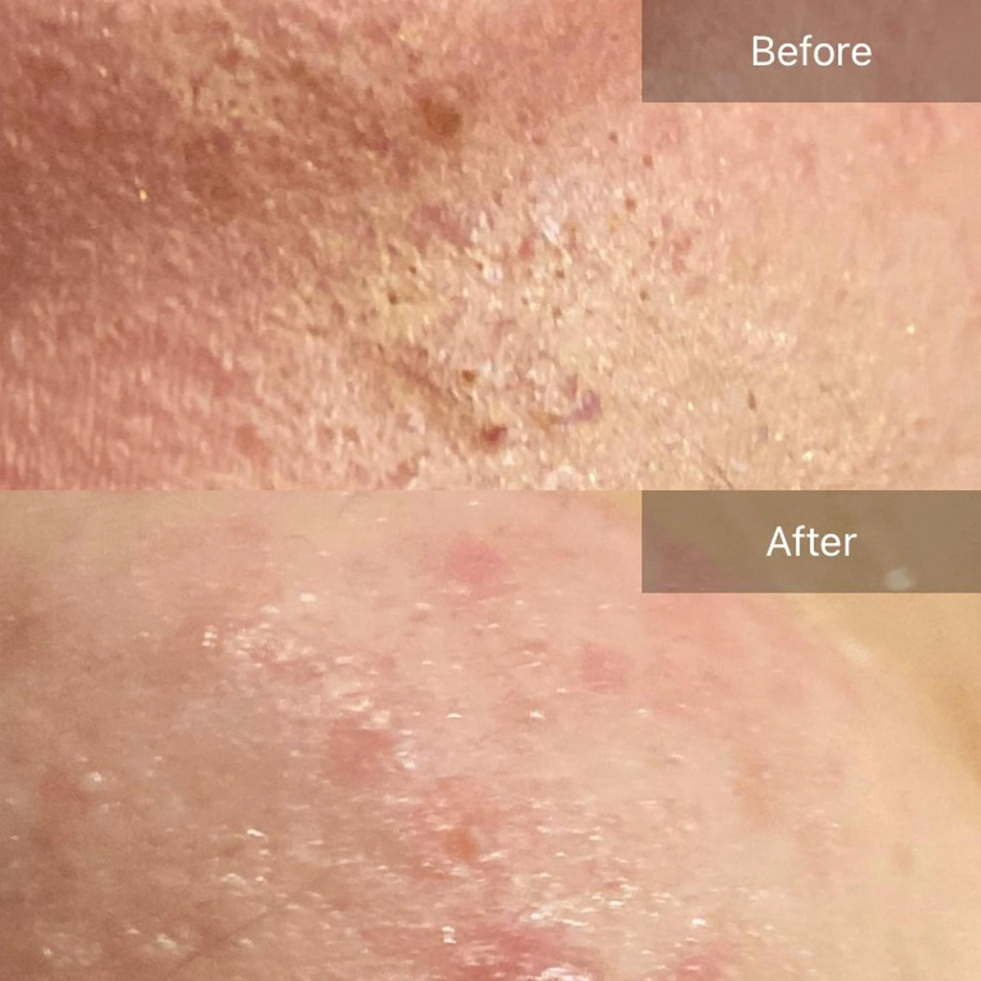 毛穴から始める肌メン テマンダリンオレンジのエステ・リラクイメージ