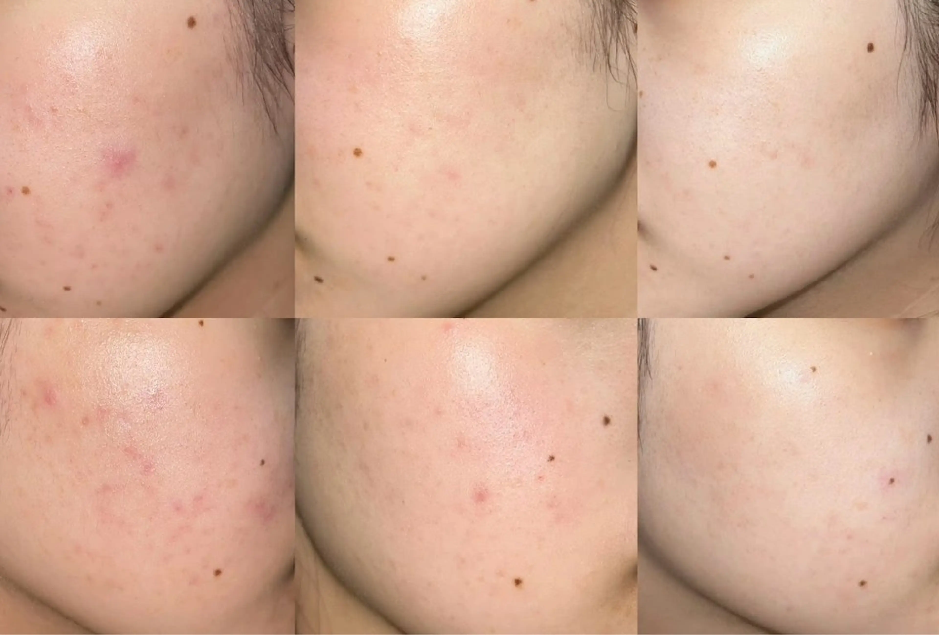 その他 韓国肌管理Belle後楽園所属・韓国肌管理Belle 後楽園のエステ・リラクイメージ