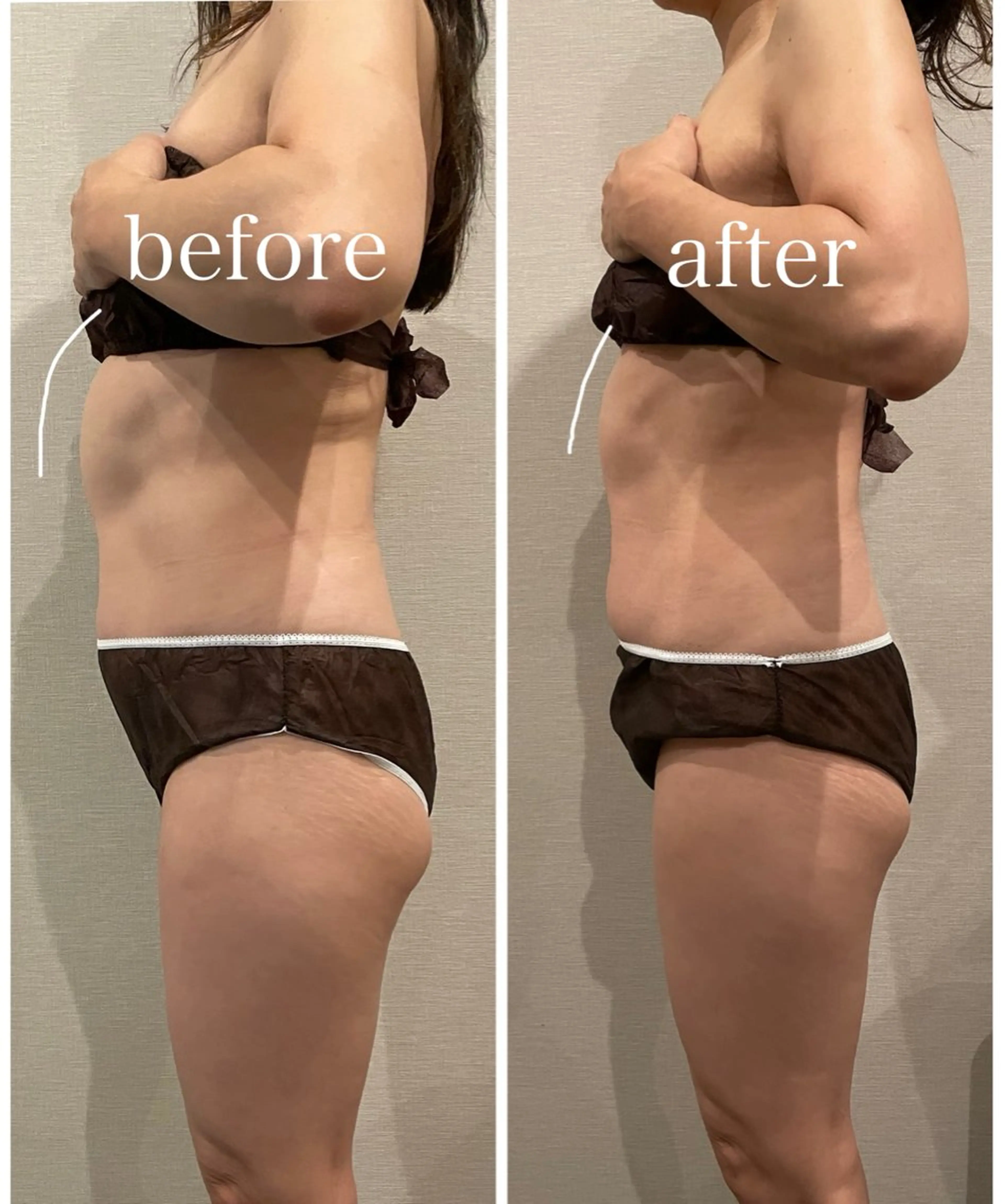 計120分　［ストレスフルな方へ］腸タイプカウンセリング30分＋オーダーメイド腸もみ90分の写真