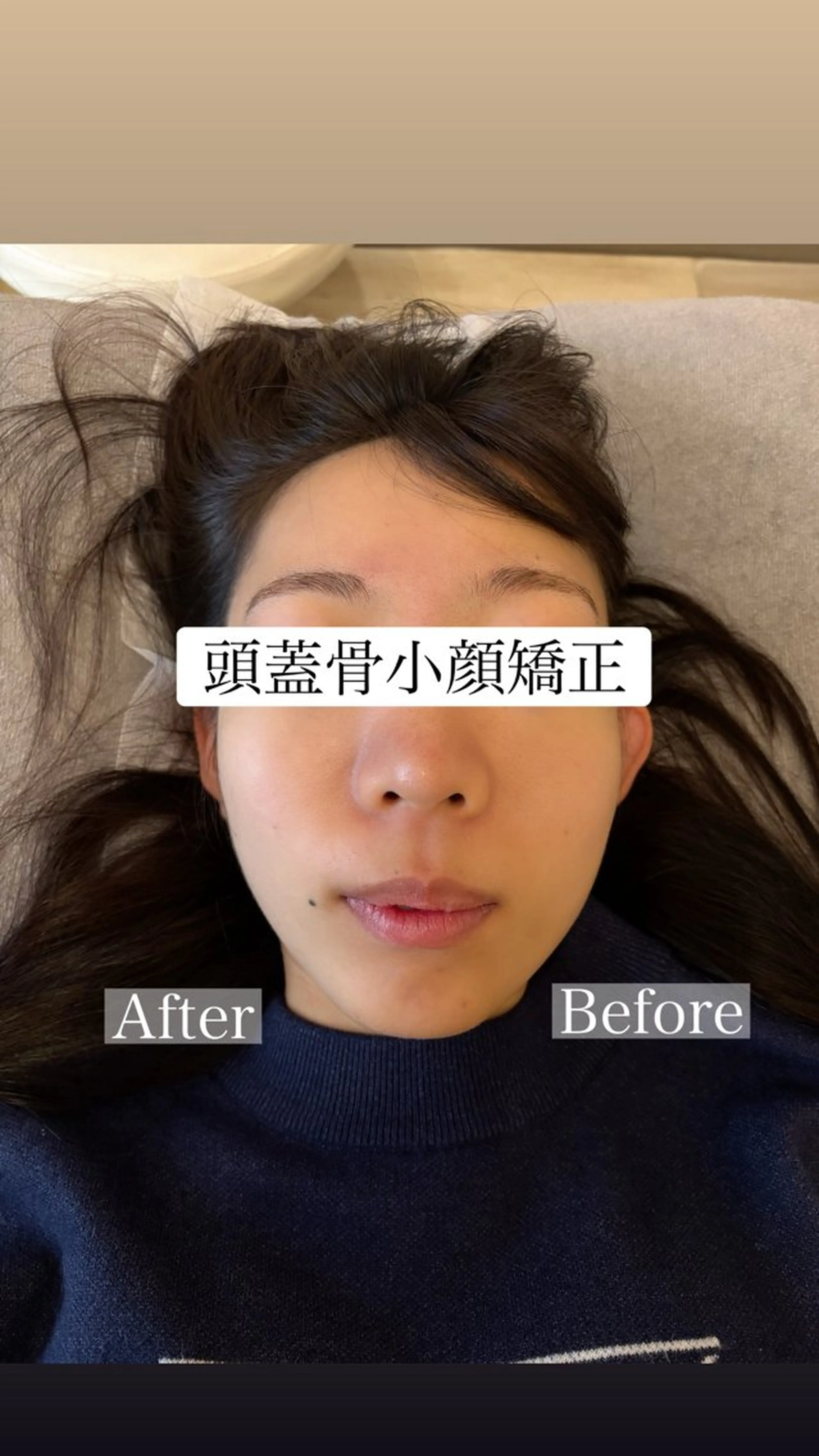 リラク Top Face立川 【小顔矯正】小川のエステ・リラクイメージ