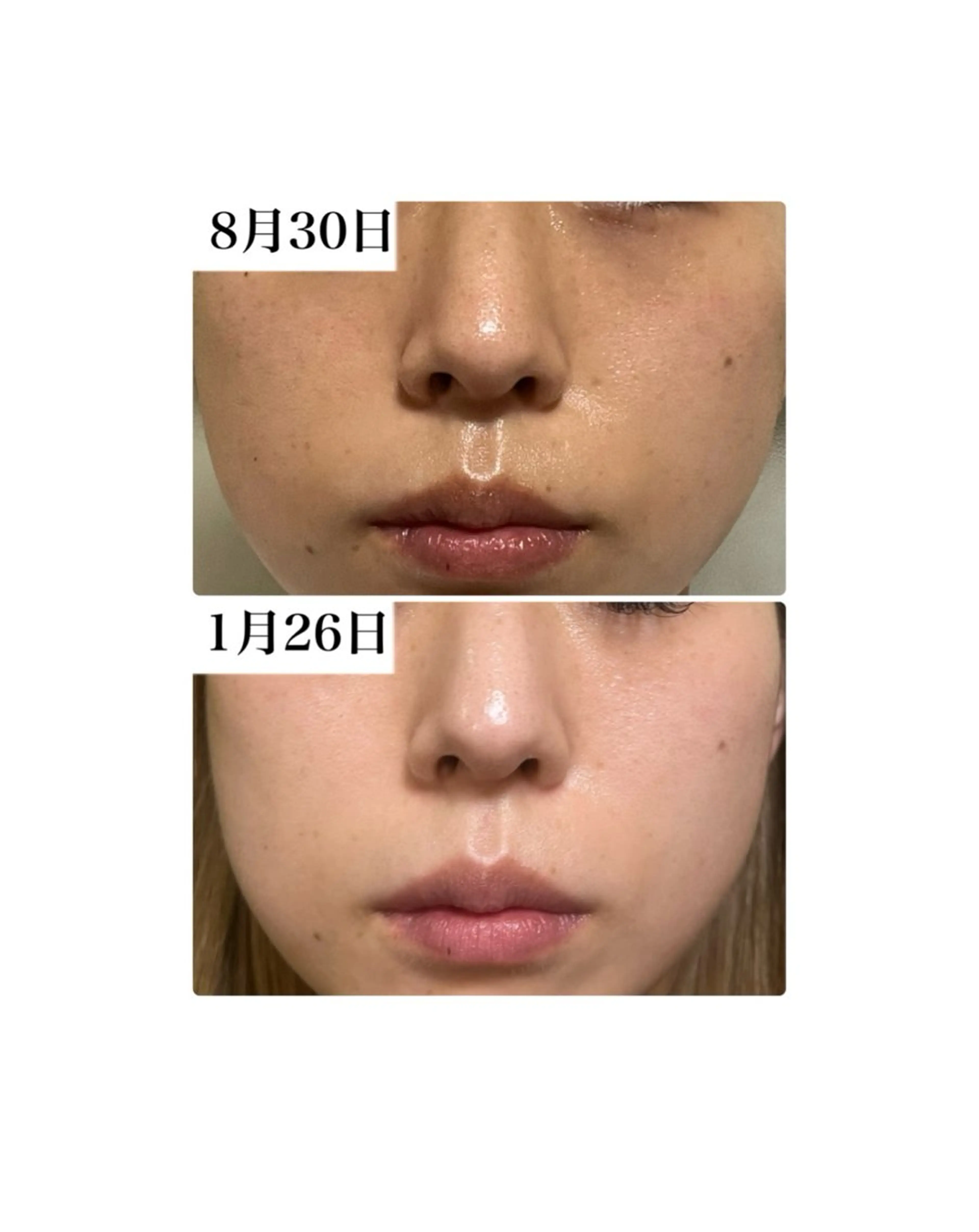 エステ ROR Akariのエステ・リラクイメージ