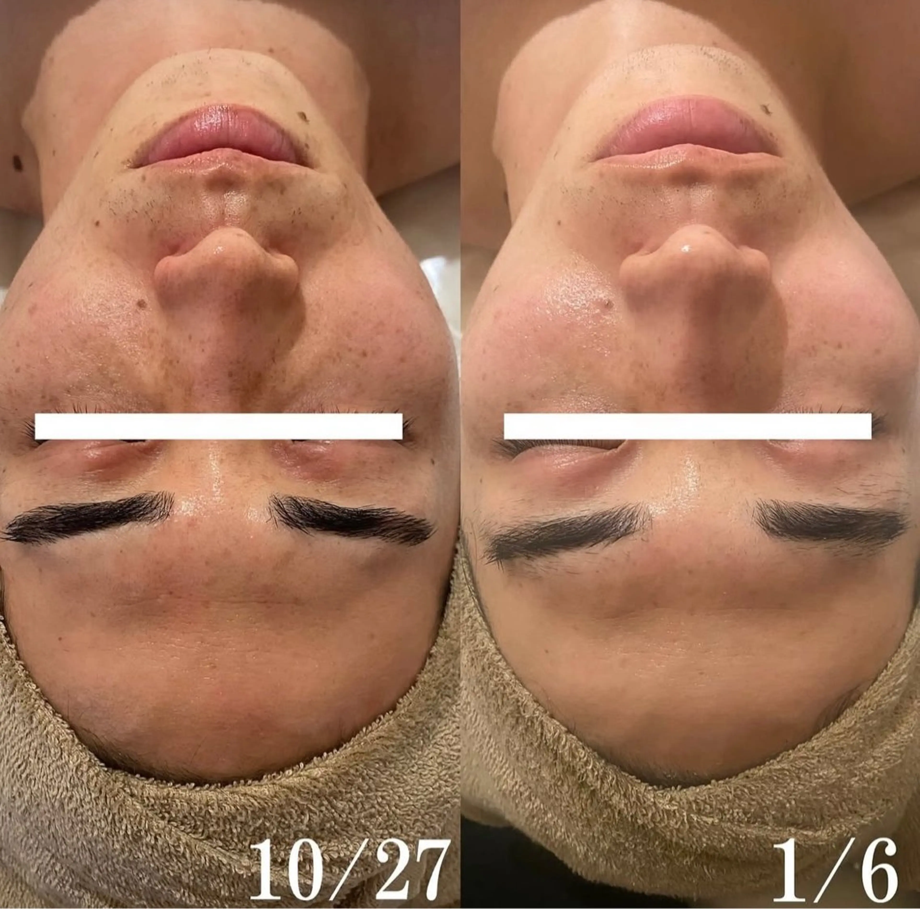 中目黒ハーブピーリン グ🌿ララピールのエステ・リラクイメージ