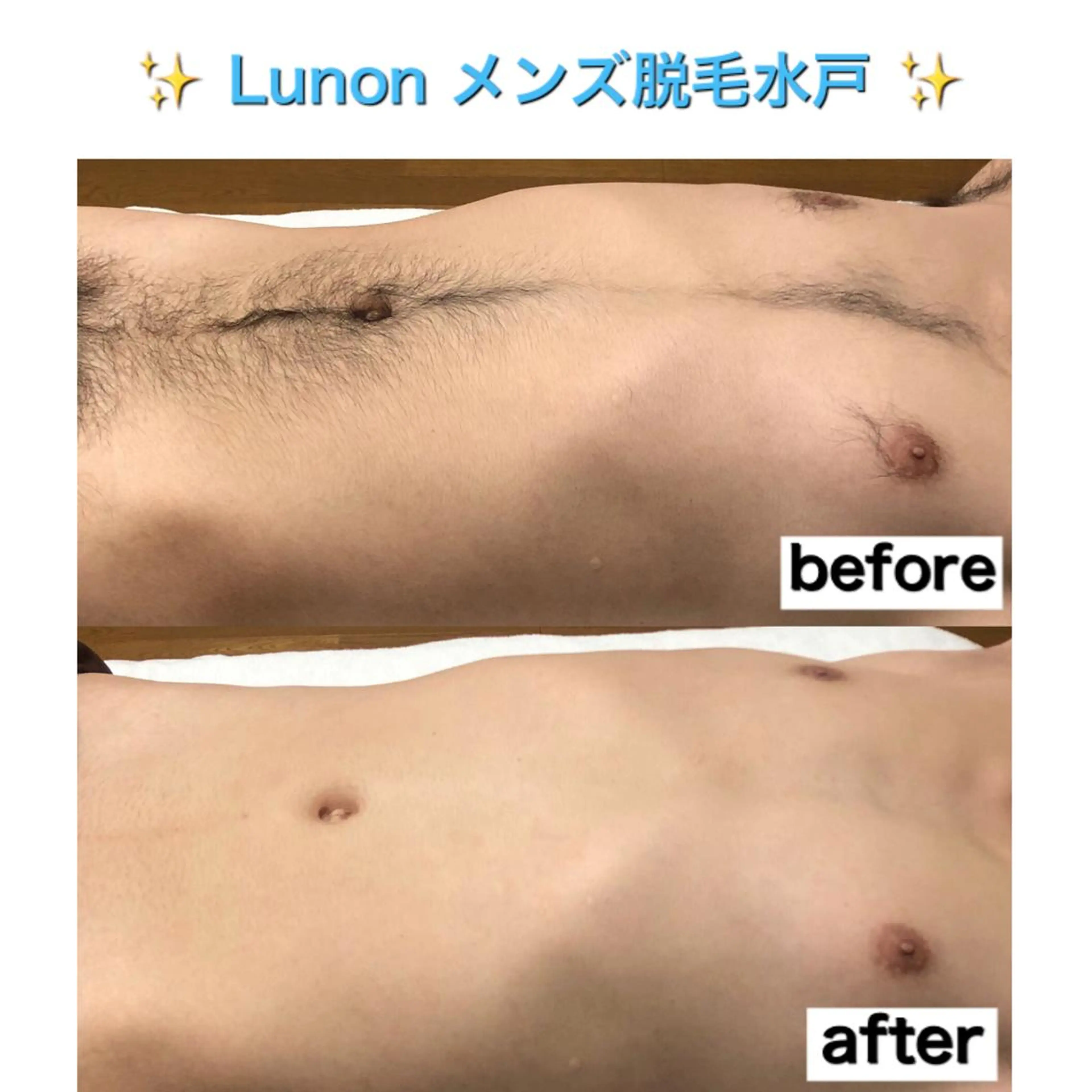 メンズ Lunon 【ルノン】のエステ・リラクイメージ