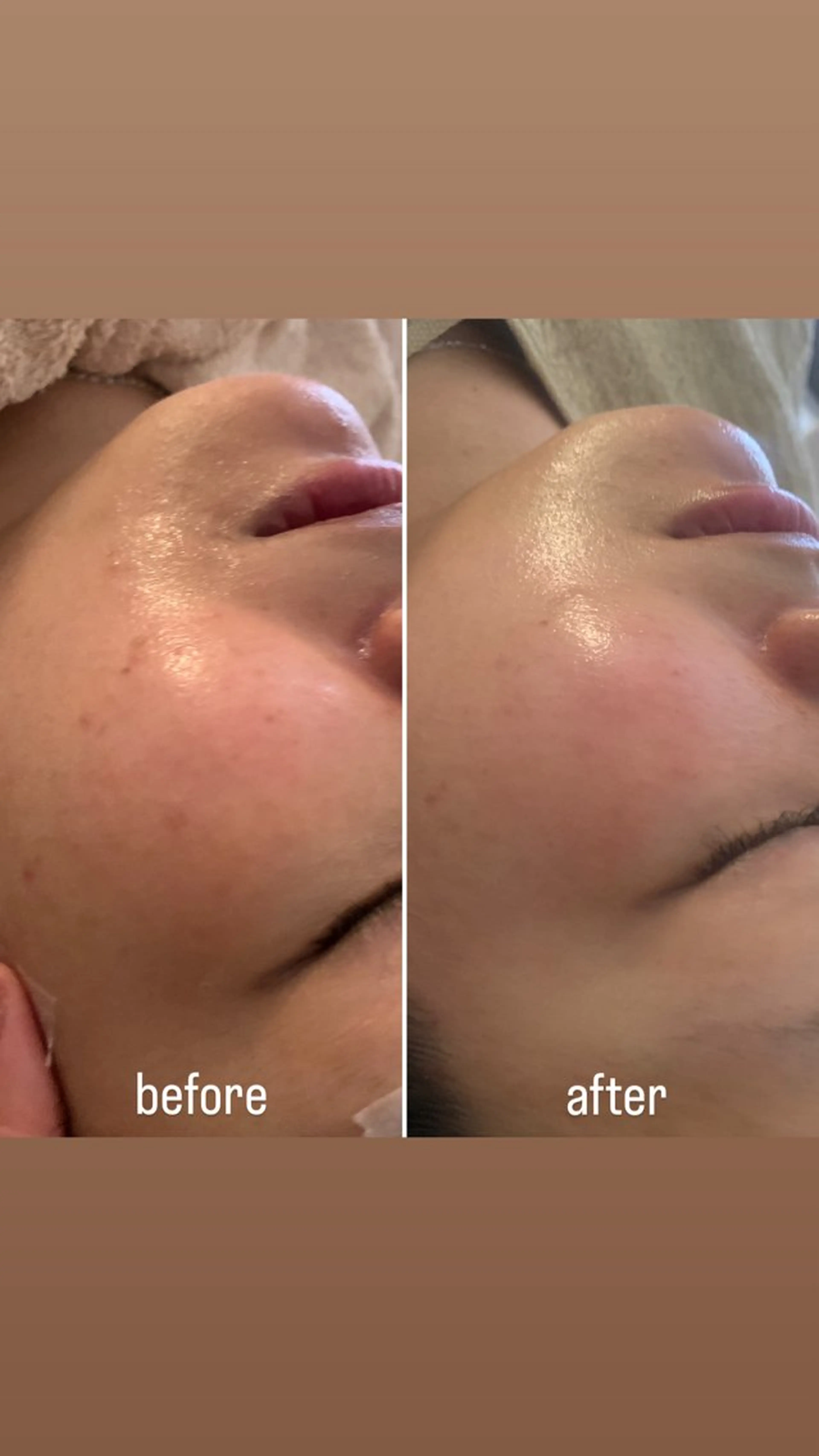 【mai*】マツヤニ ボディ/ベッドスパのエステ・リラクイメージ