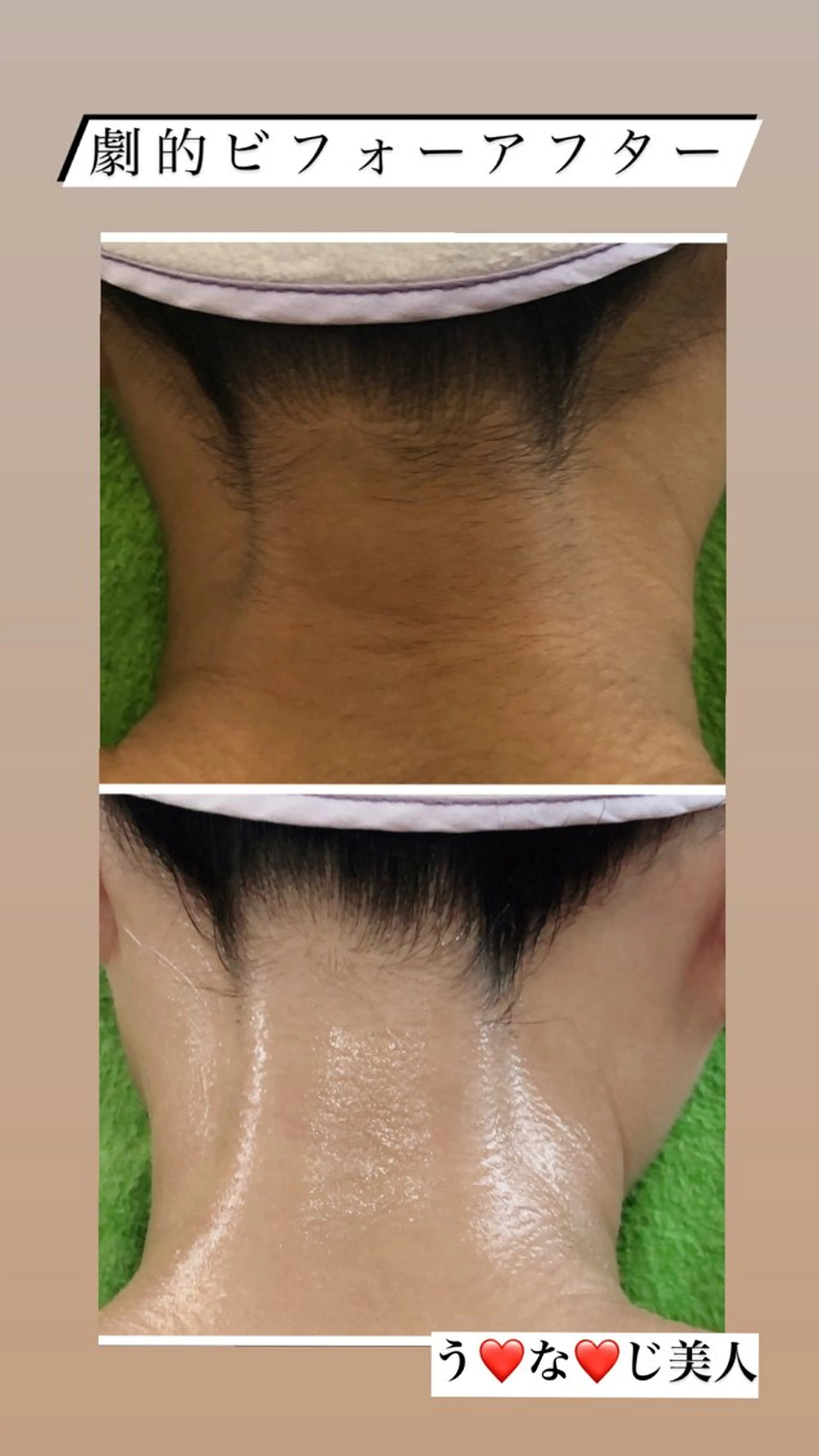 宜野湾美肌脱毛fuu okinawaタイラのエステ・リラクイメージ