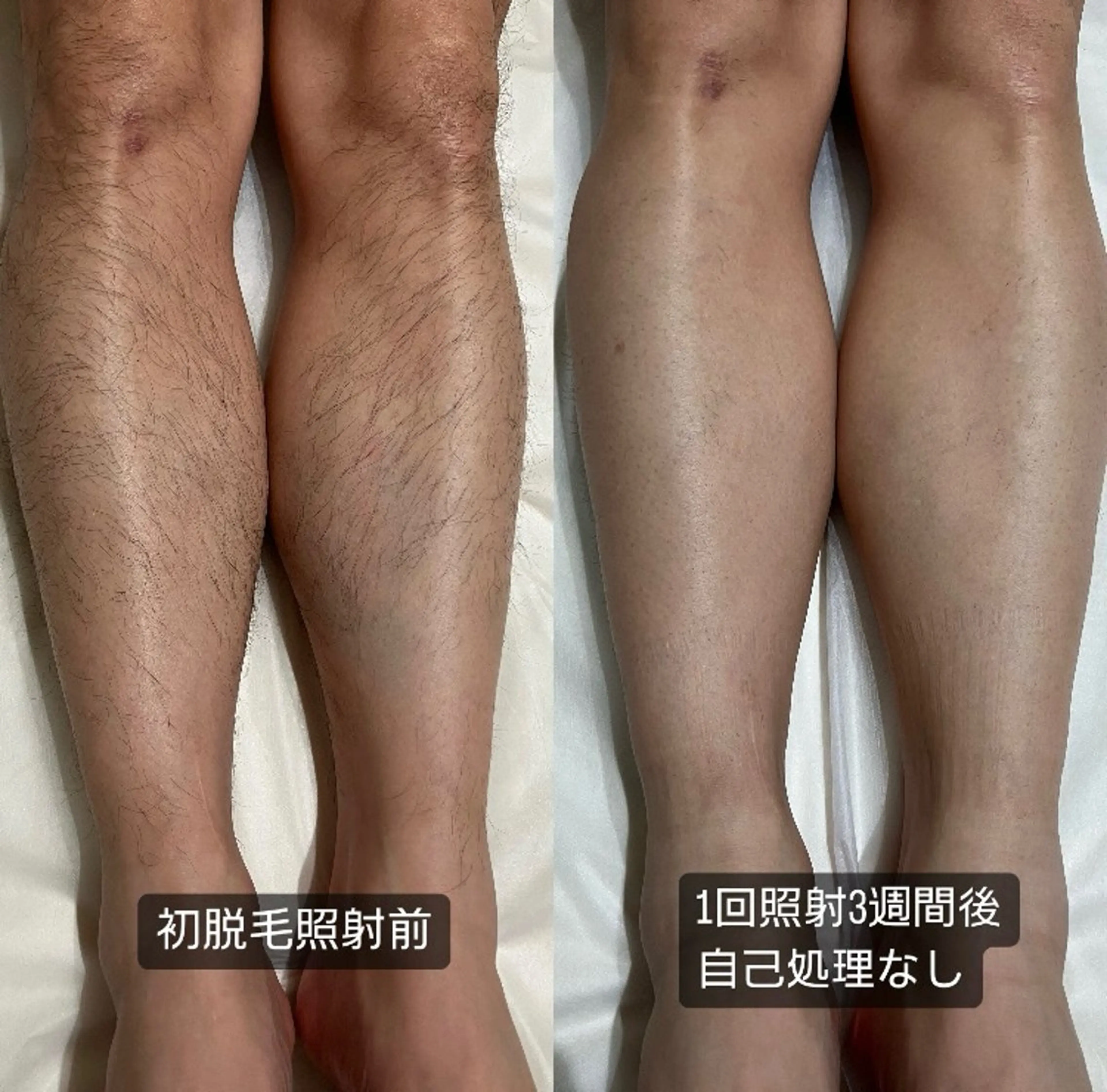 Felimor. フェリモールのエステ・リラクイメージ