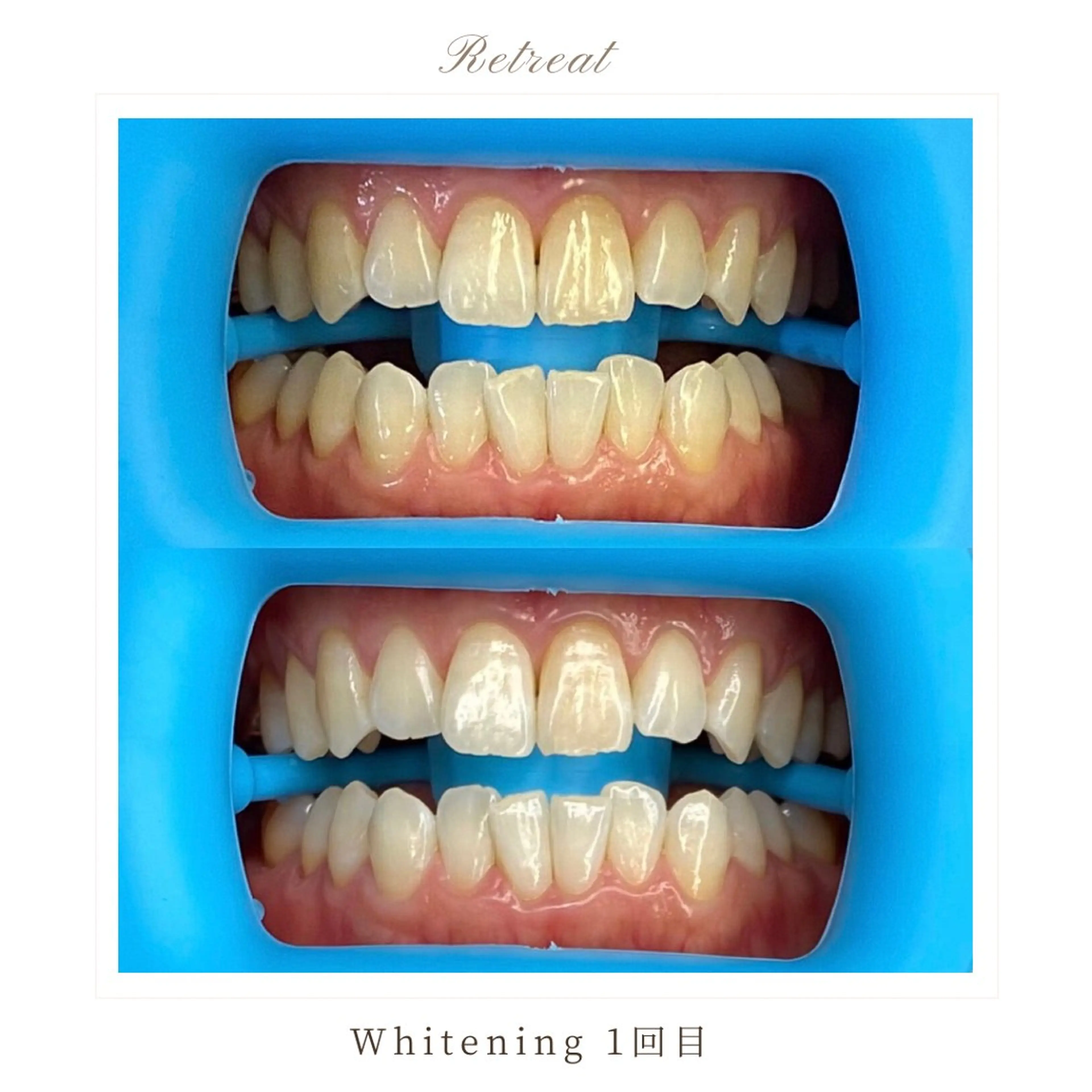 歯科医院提携 Retreatのエステ・リラクイメージ