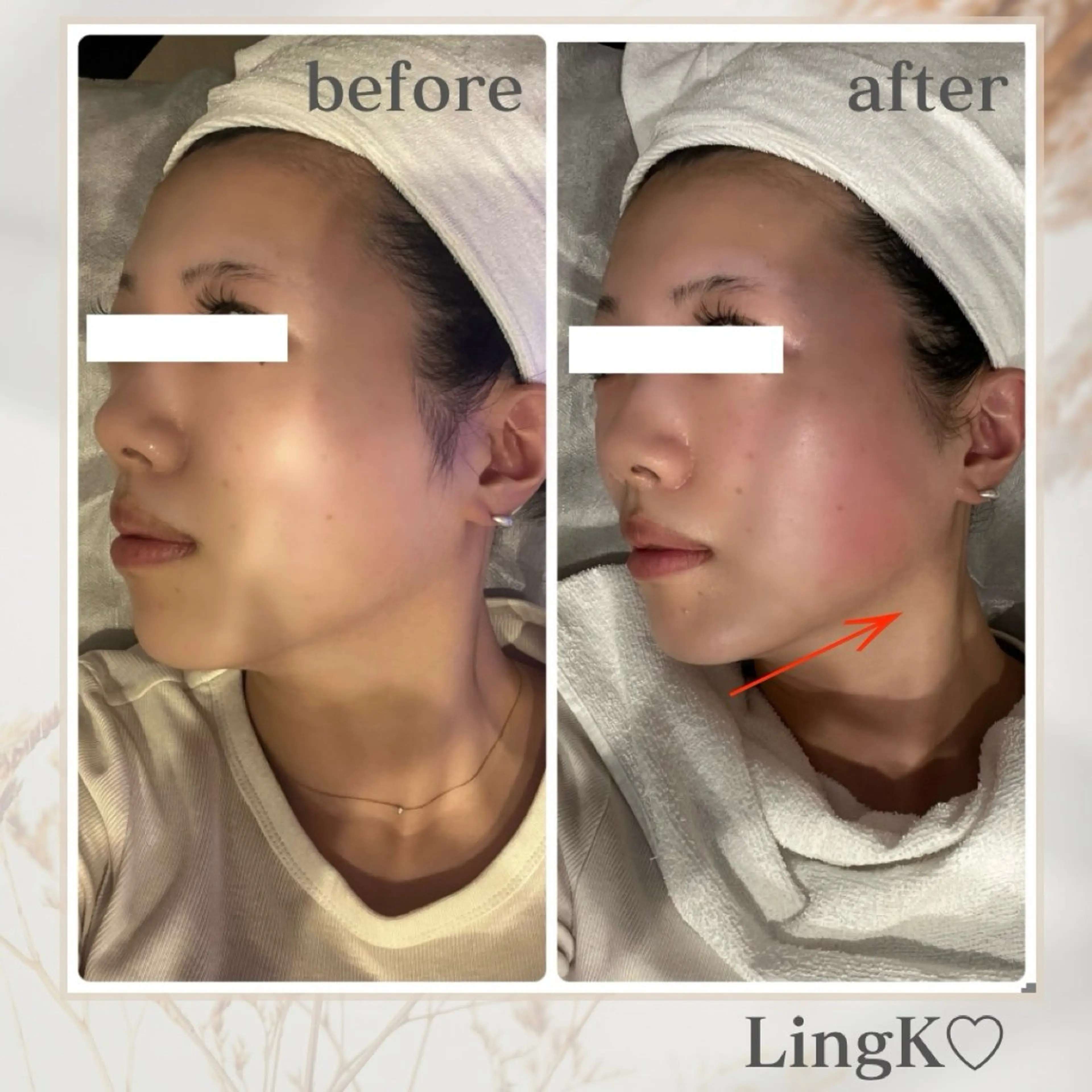 LingK/Este 中松 聖奈のエステ・リラクイメージ