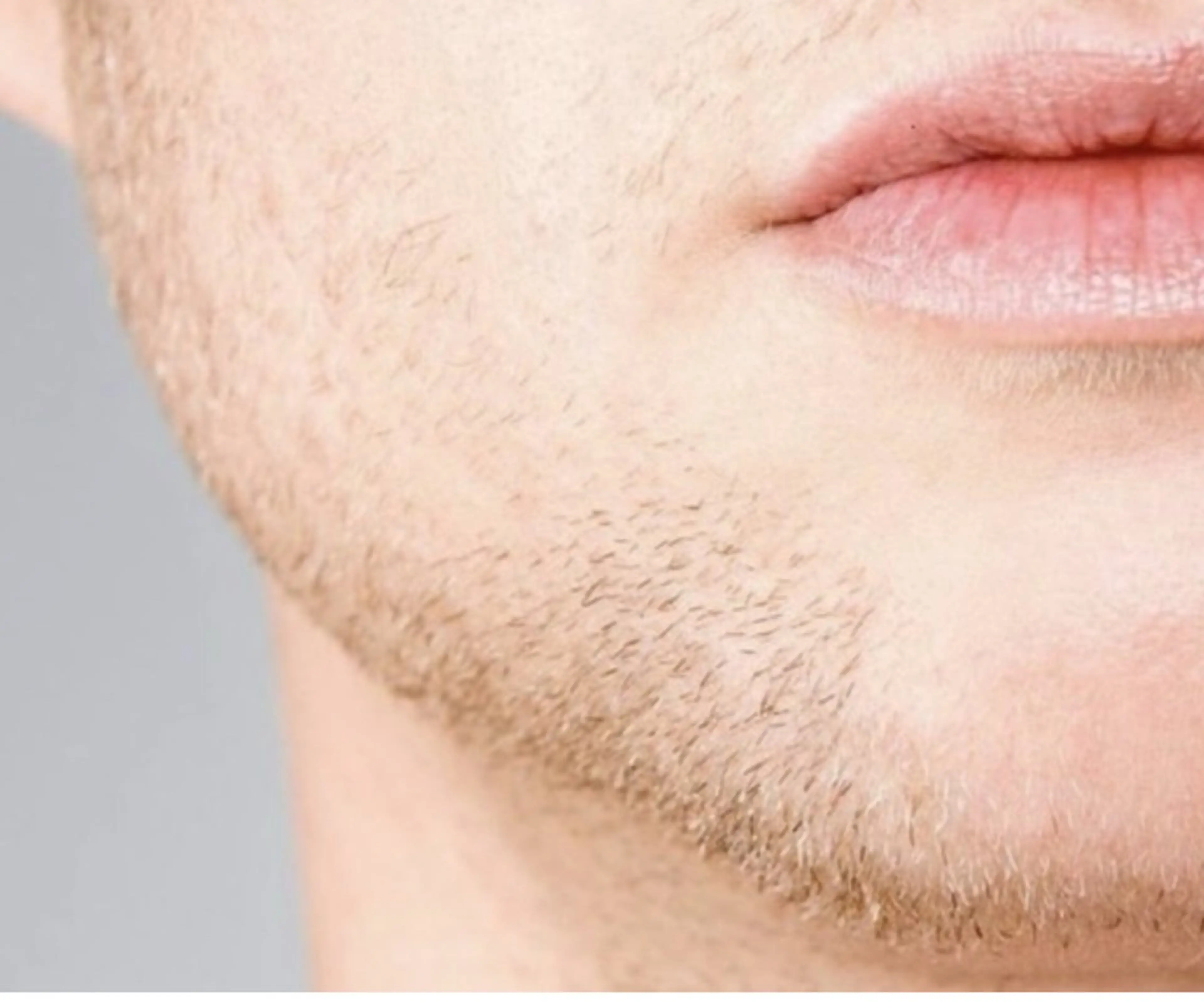 ヒゲ脱毛お任せください！つるすべ肌を手に入れましょう☆(お顔全体➕首のご希望箇所すべて)の写真